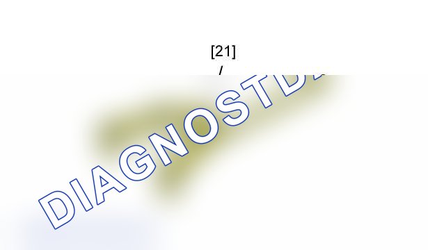Повторная установка: двигателя DW12TED4 - DW12UTED — e5am0qkd. Peugeot 607 I рестайлинг