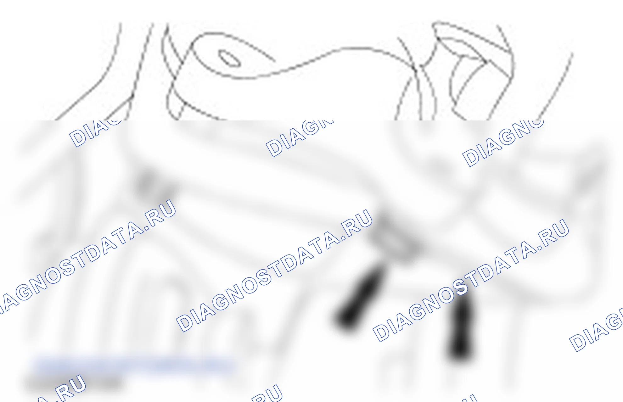 Как снять и установить турбокомпрессор (Варианты с промежуточным охлаждением) — Удалить и установить (23 612 0). Ford Escort V рестайлинг