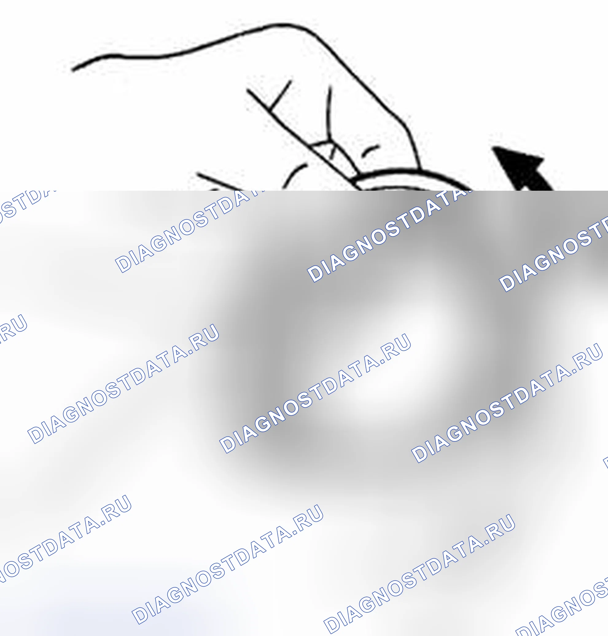 Рис. 100: Подшипник. Suzuki Equator I