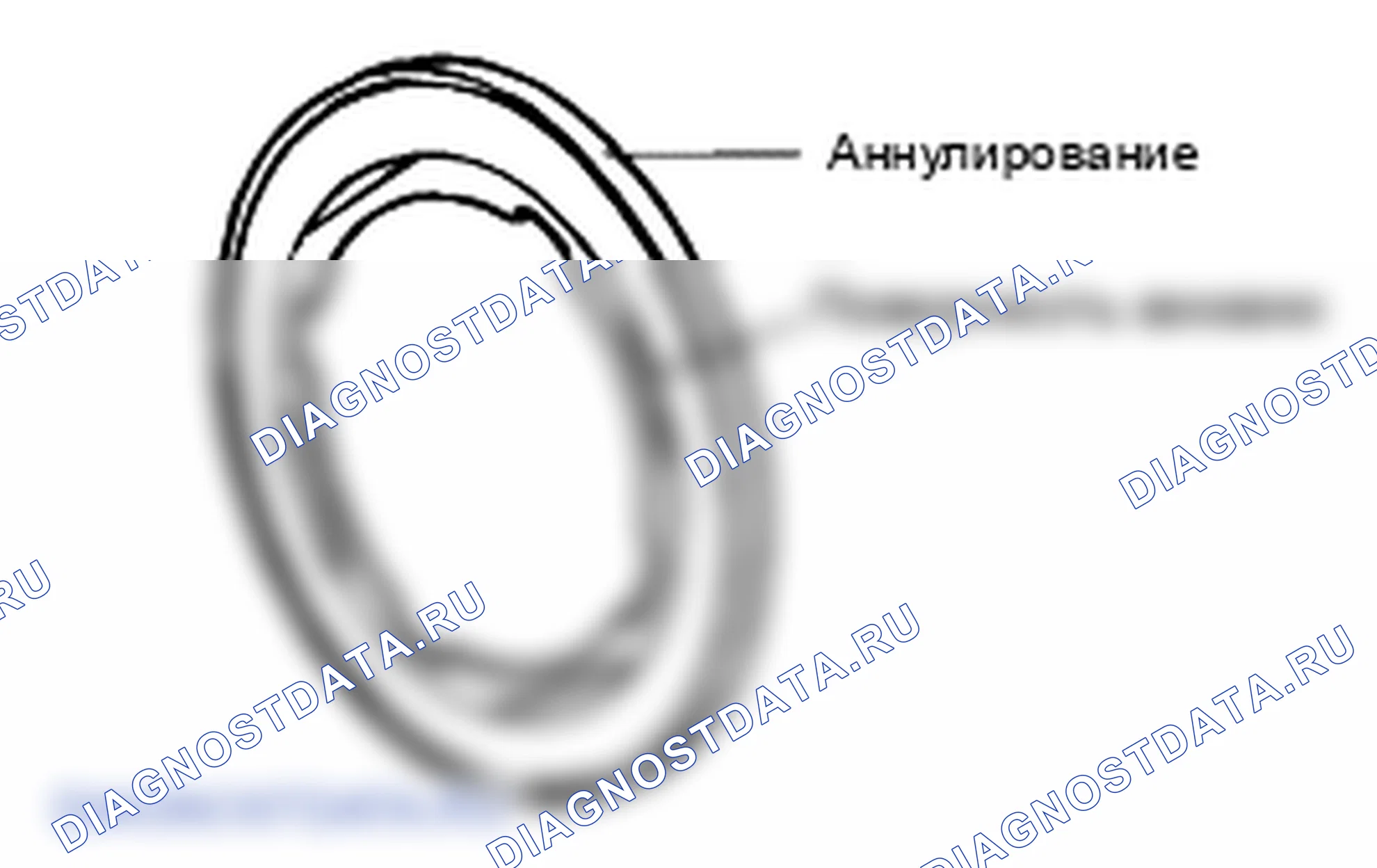 Проверка низкого сцепления. Hyundai Atos MX