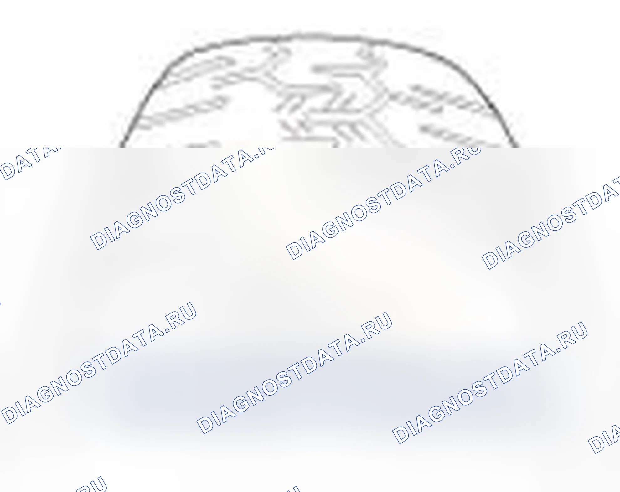 Рис. 41. Hyundai Veloster I