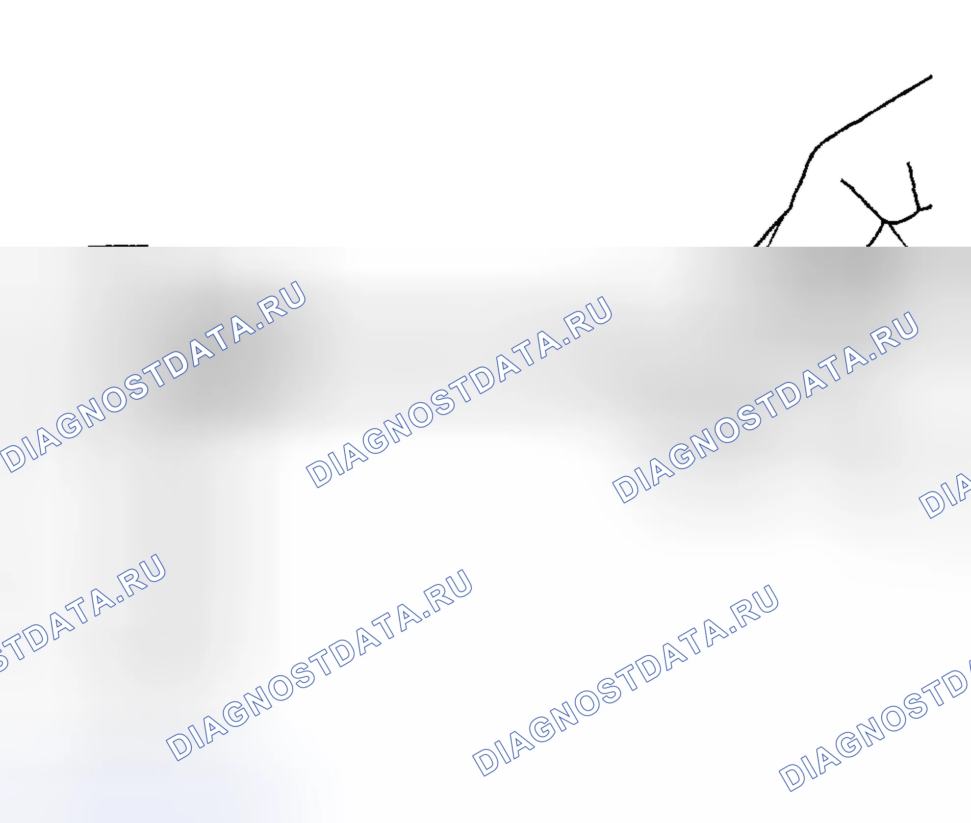 Рис. 1313. Hyundai Terracan I