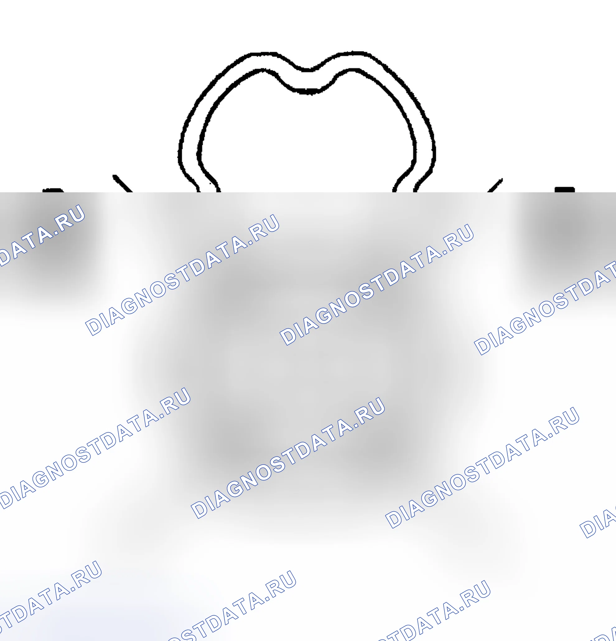 Рис. 554: Процедура установки. Hyundai Venue I