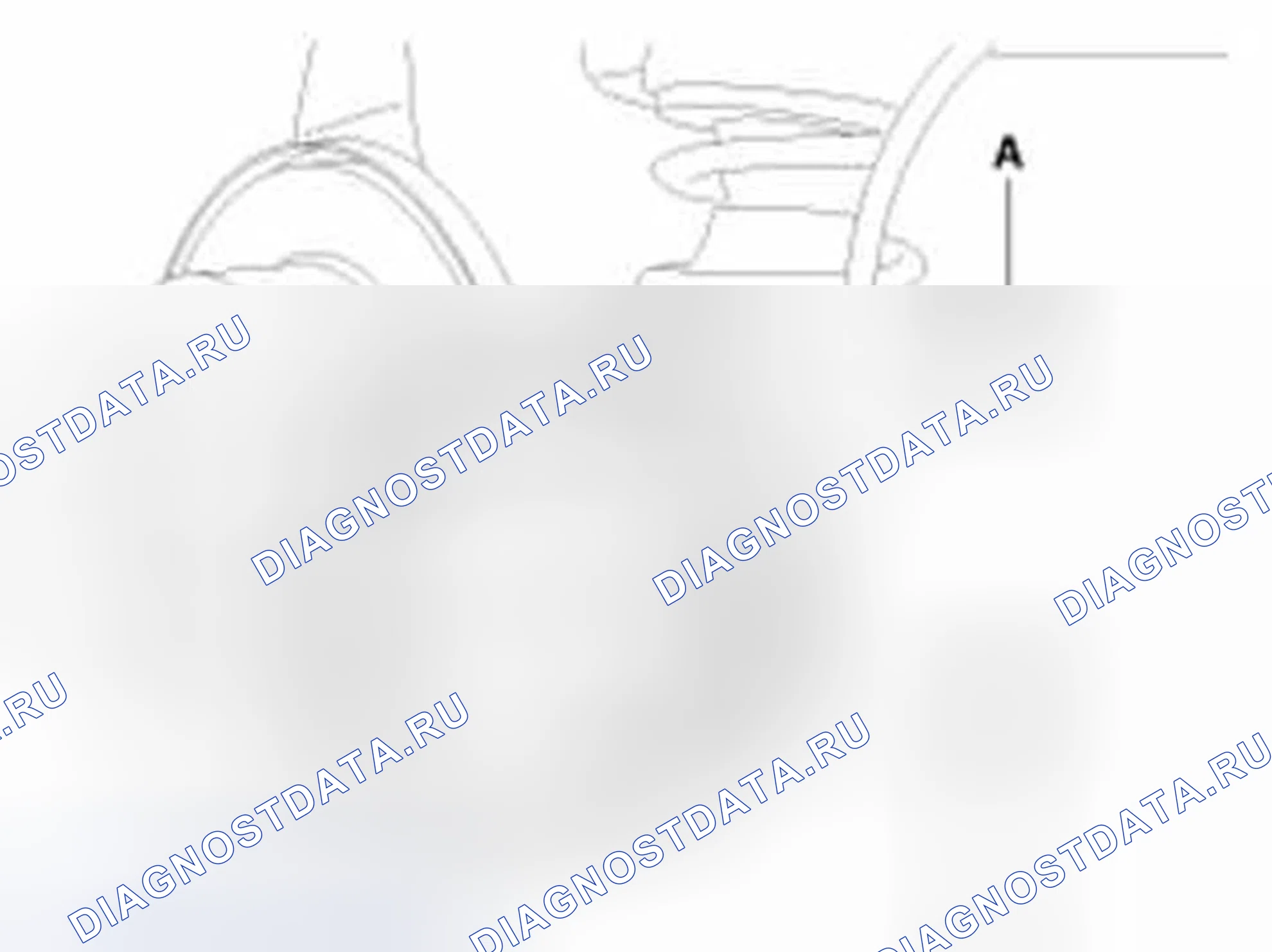 Рис. 85. Hyundai Elantra V