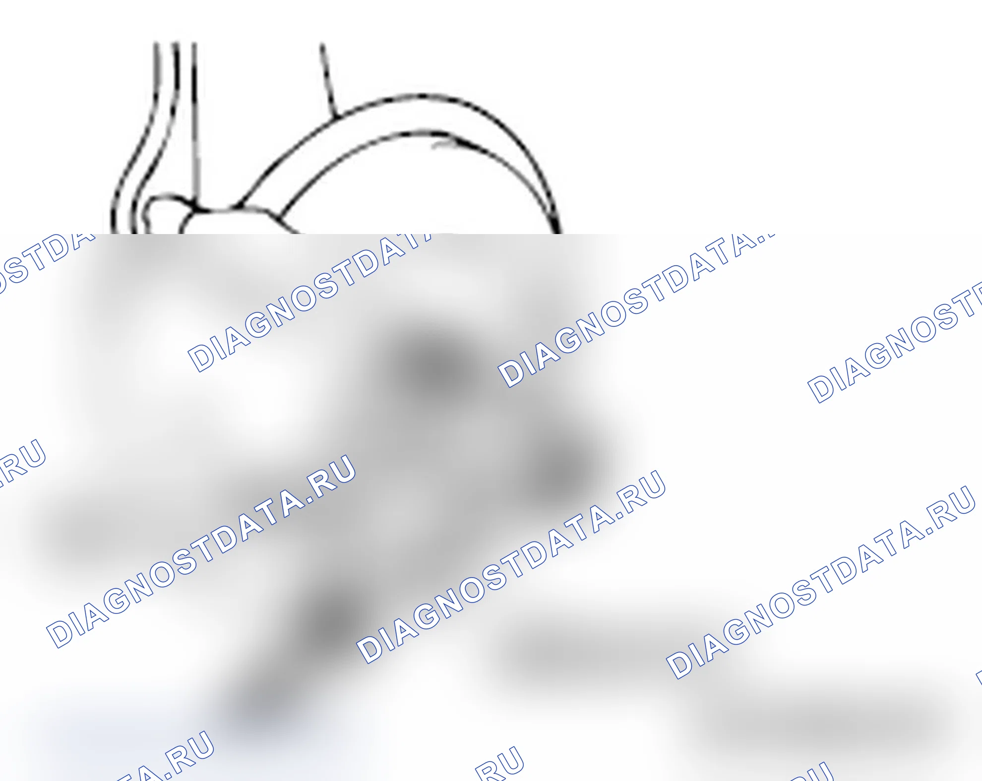 Рис. 169. Mitsubishi Lancer Ralliart X рестайлинг