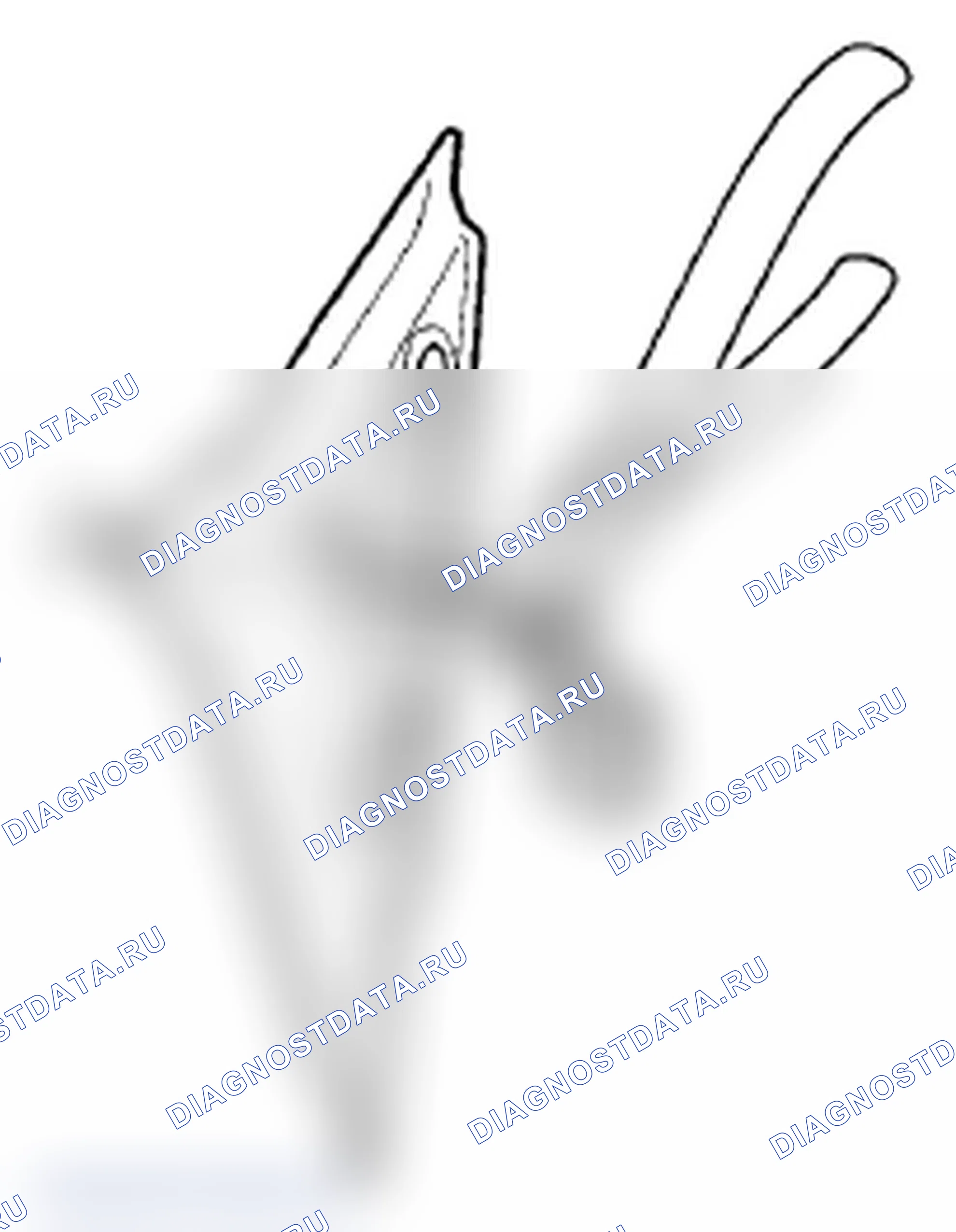 Рис. 18. Acura TL IV рестайлинг