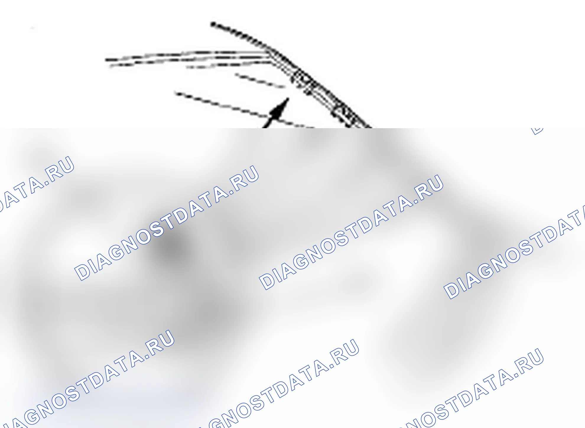Рис. 188: Замена зажима со стороны тела. Acura MDX II