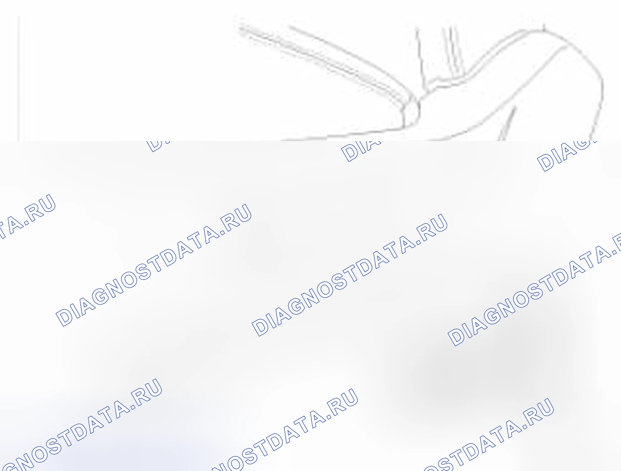 Рис. 117: Удаление. Kia Optima III