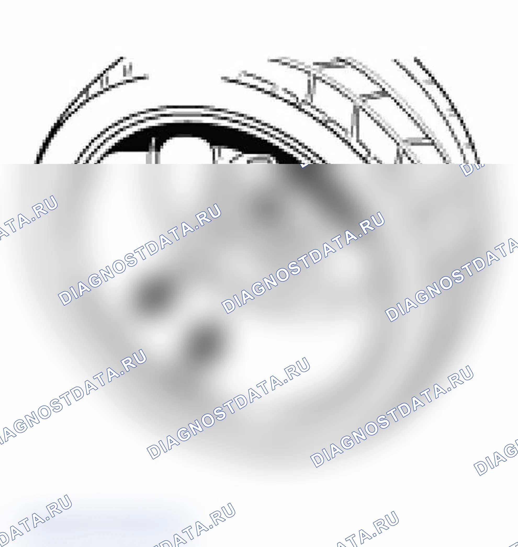 Рис. 31: Балансировочные грузы. Porsche Boxster S 986