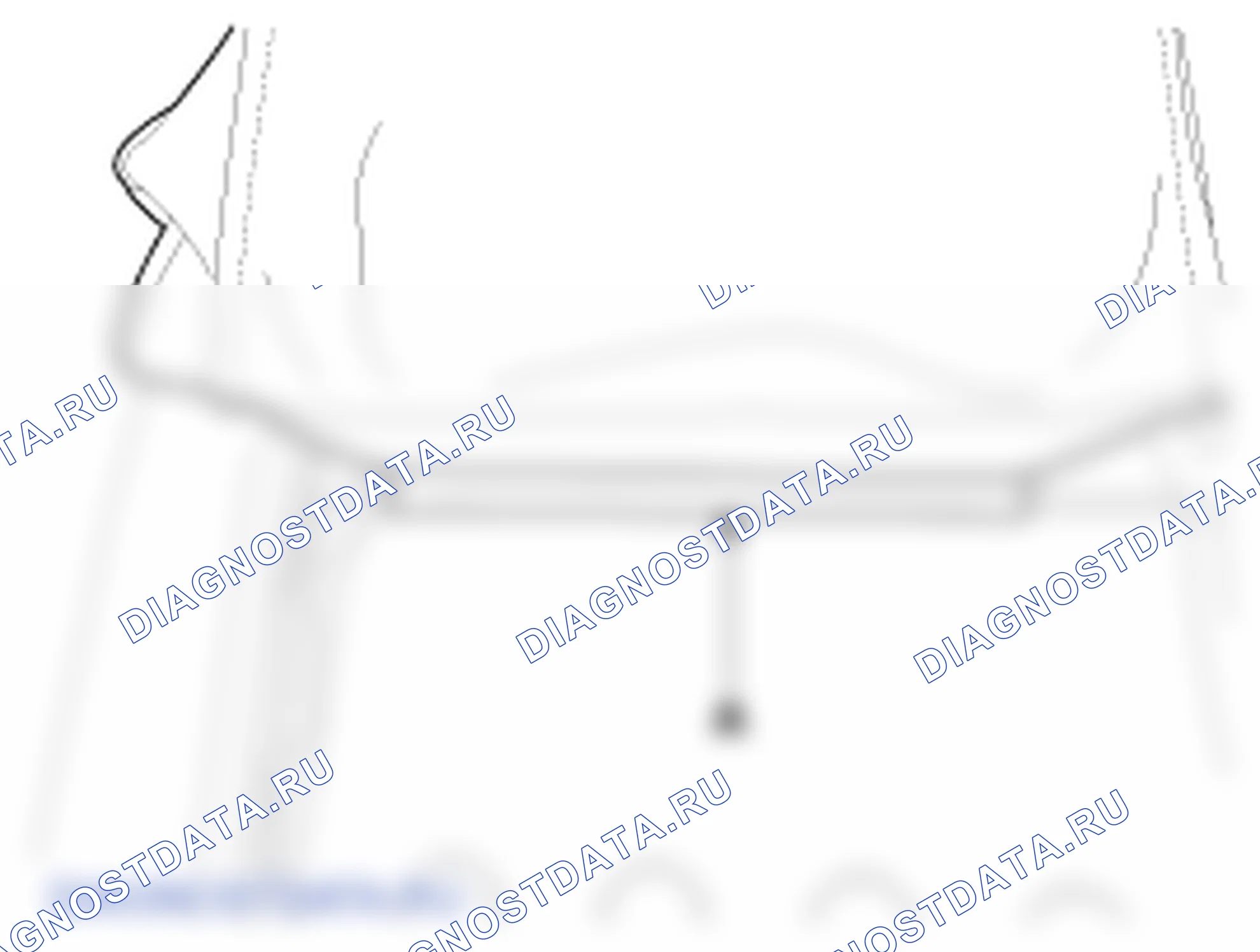 Замена крышки спинки переднего сиденья. Hyundai GRAND i10/Xcent BA