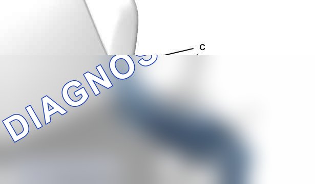 Разборка-сборка: переднего сиденья — c5gs088d. Peugeot 2008 I
