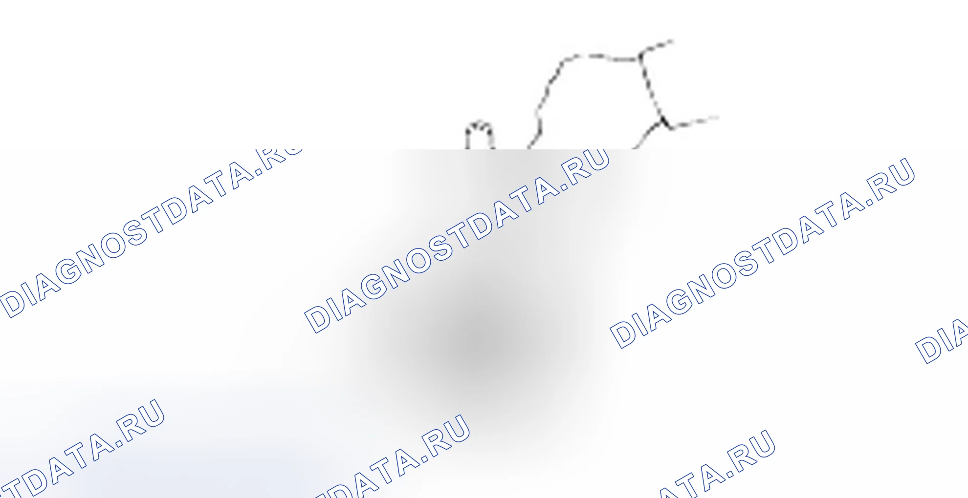Сборка муфты реверса и овердрайва. Hyundai H-1 A1