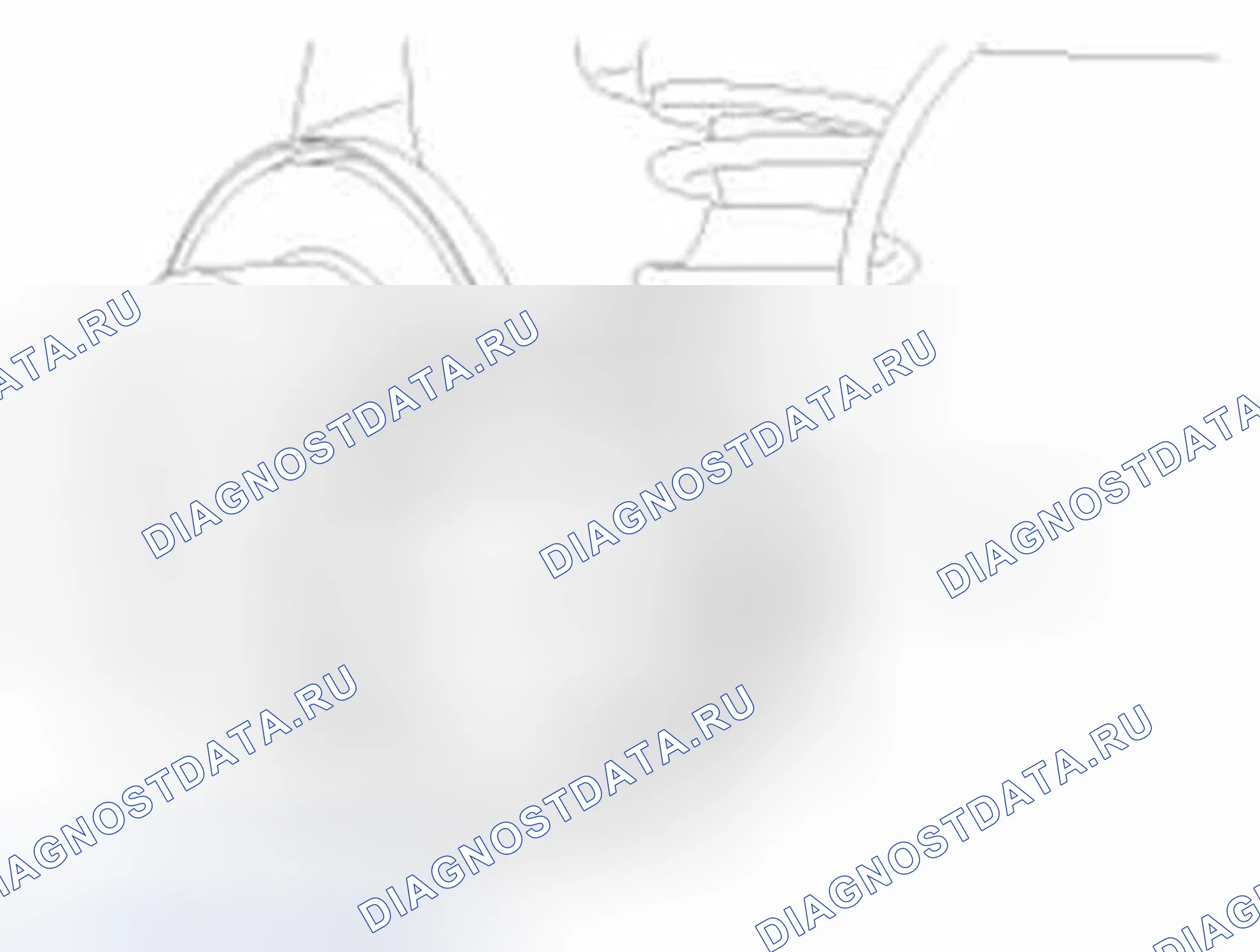 Рис. 79. Hyundai Elantra V