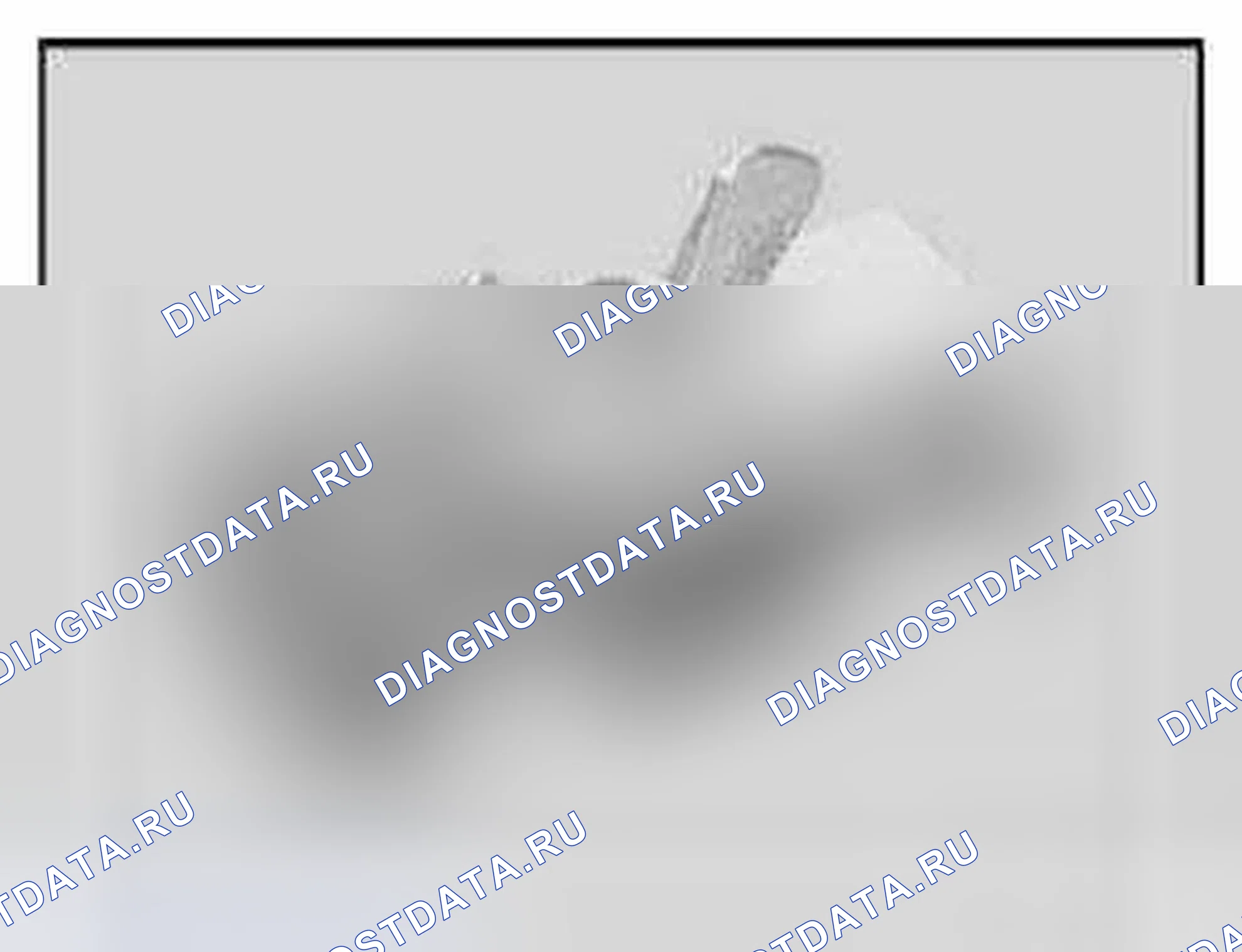 Рис. 198: 33 0 170 Калибр. BMW M5 E60/E61