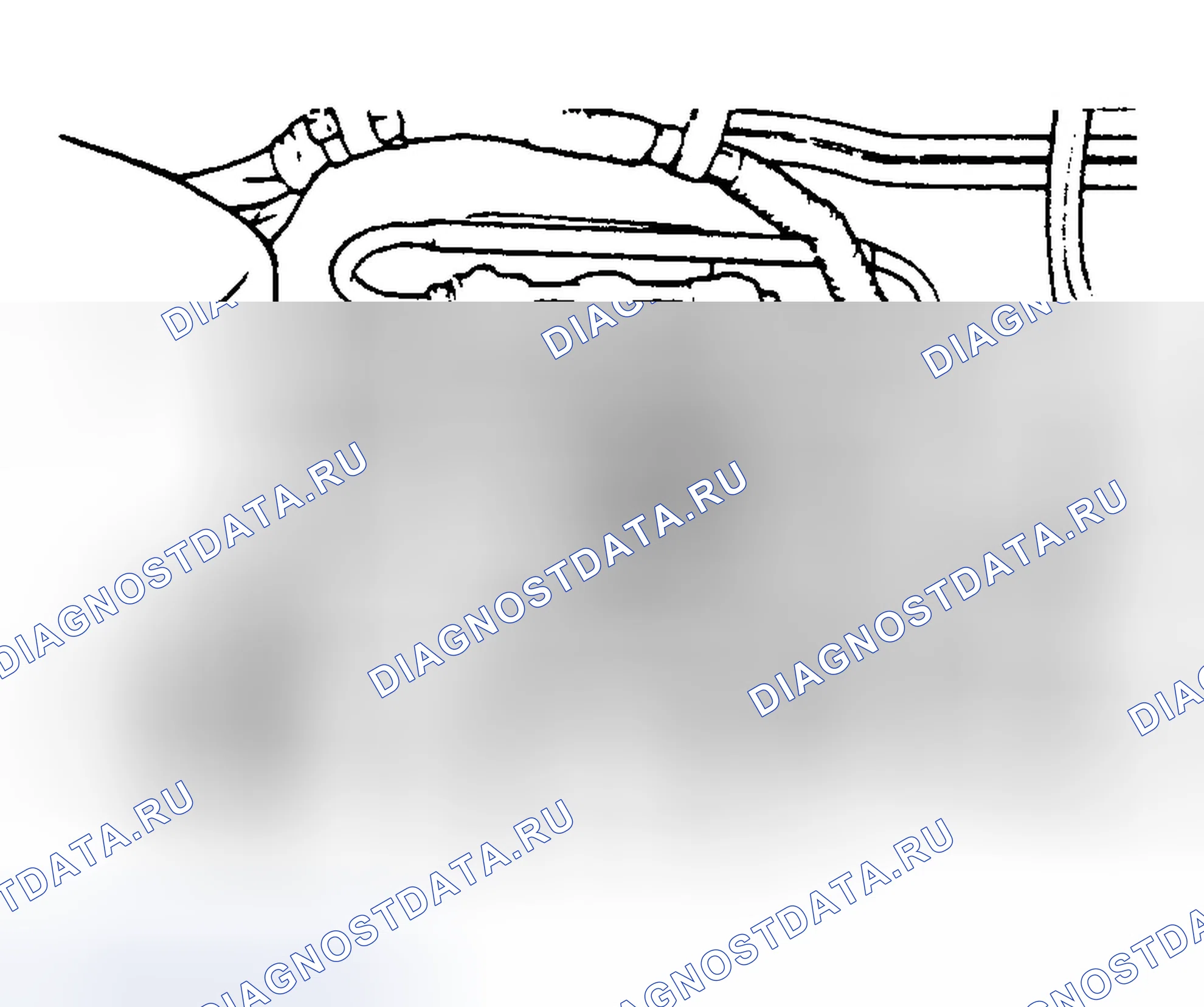 Рис. 19. Hyundai Elantra III