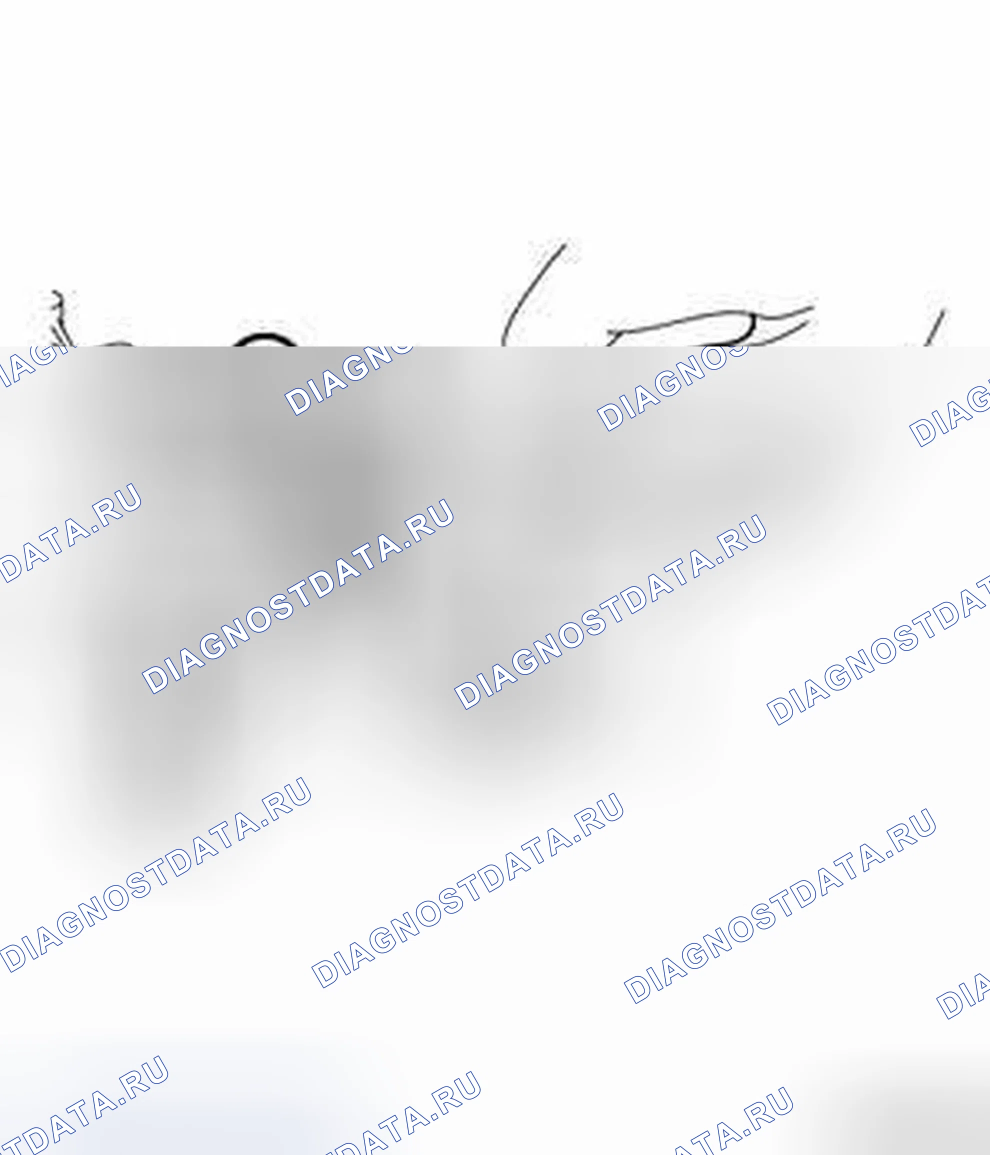 Рис. 6: ДЕМОНТАЖ. Dodge Dart PF
