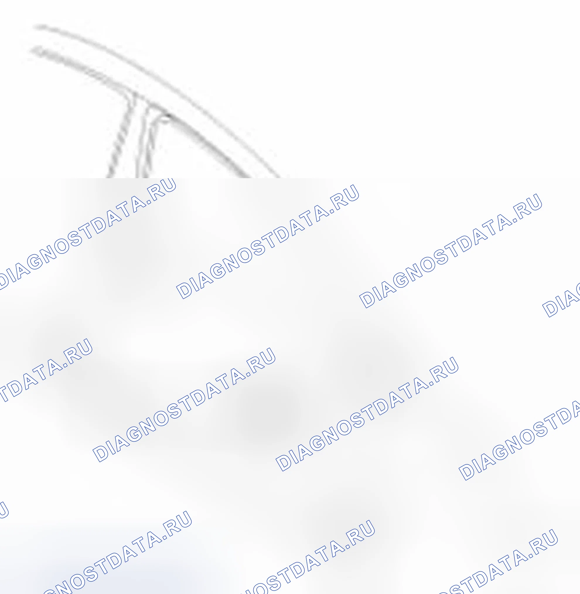 Рис. 75: Замена Delta Garnish. Hyundai Elantra V