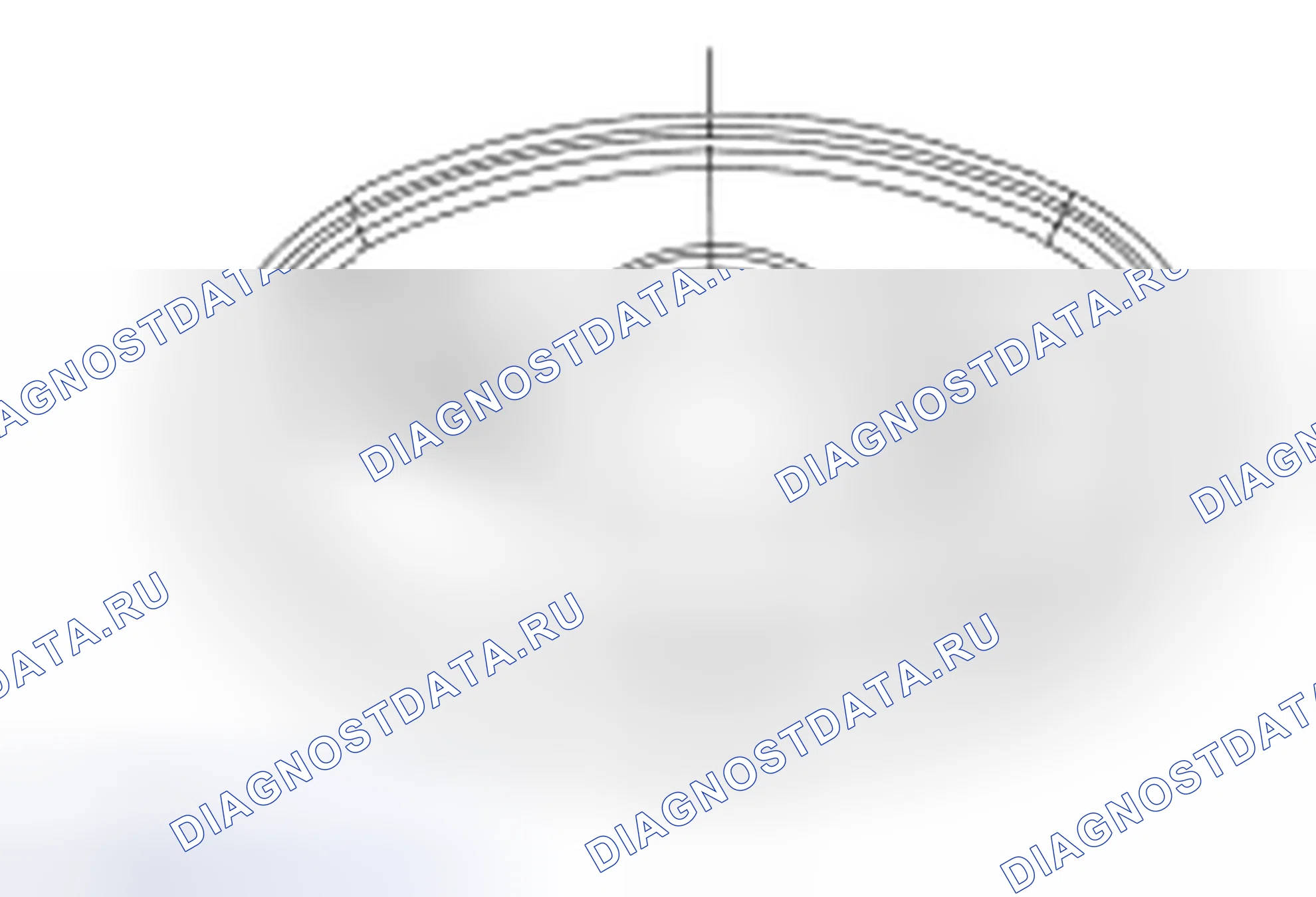 Рис. 2: Зажим Torca®. Hyundai Lafesta I