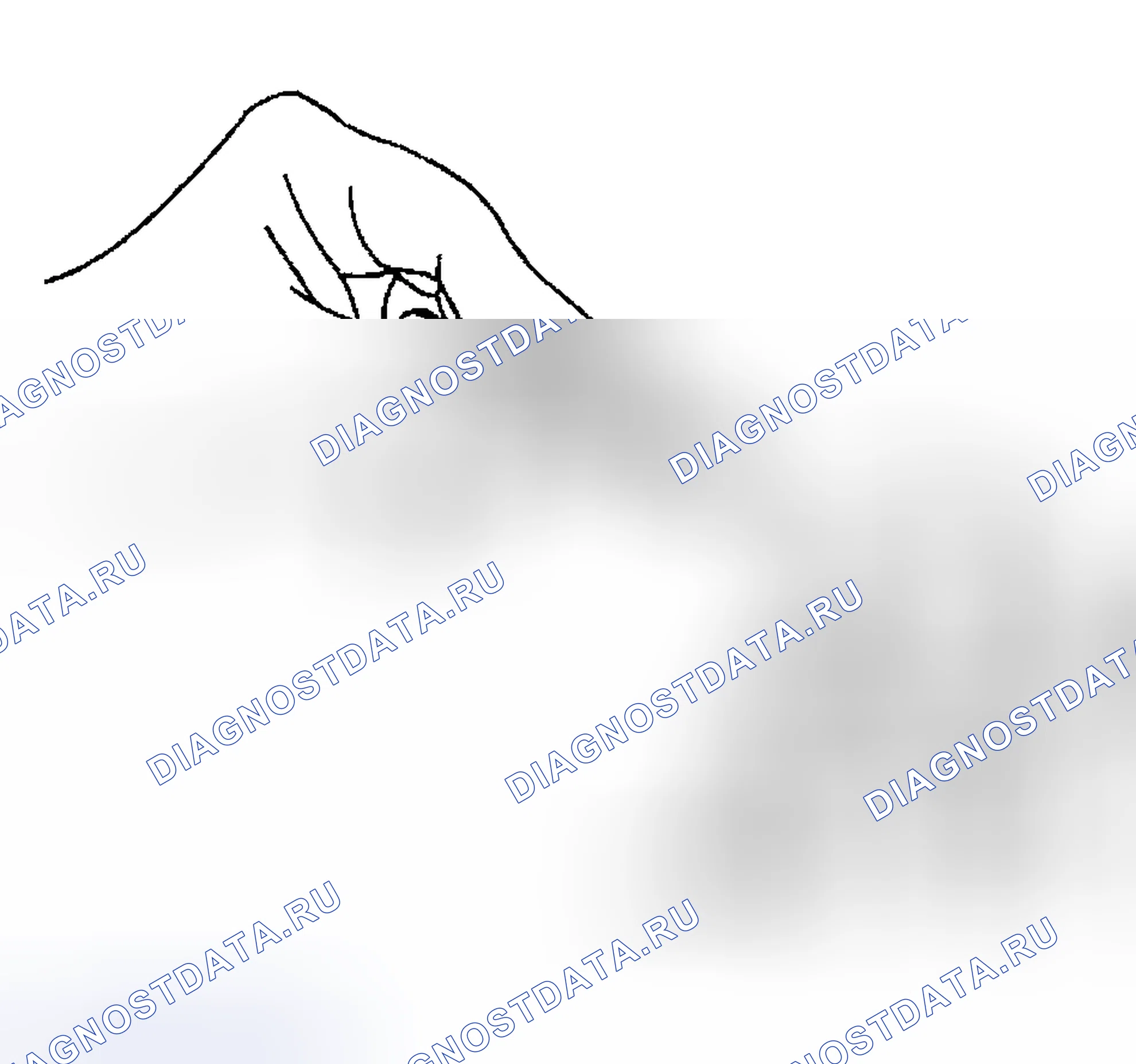 Рис. 101: Процедура установки. Hyundai Venue I