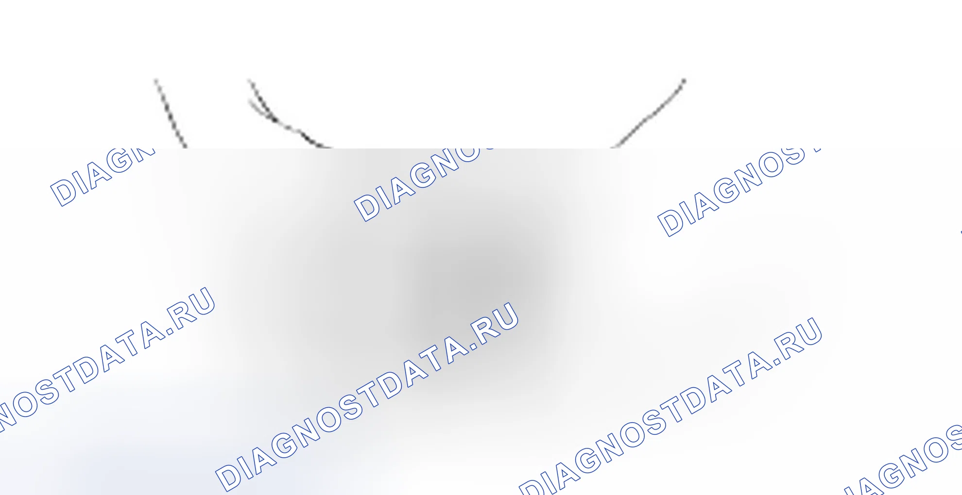 Разборка муфты реверса и овердрайва. Hyundai H-1 A1