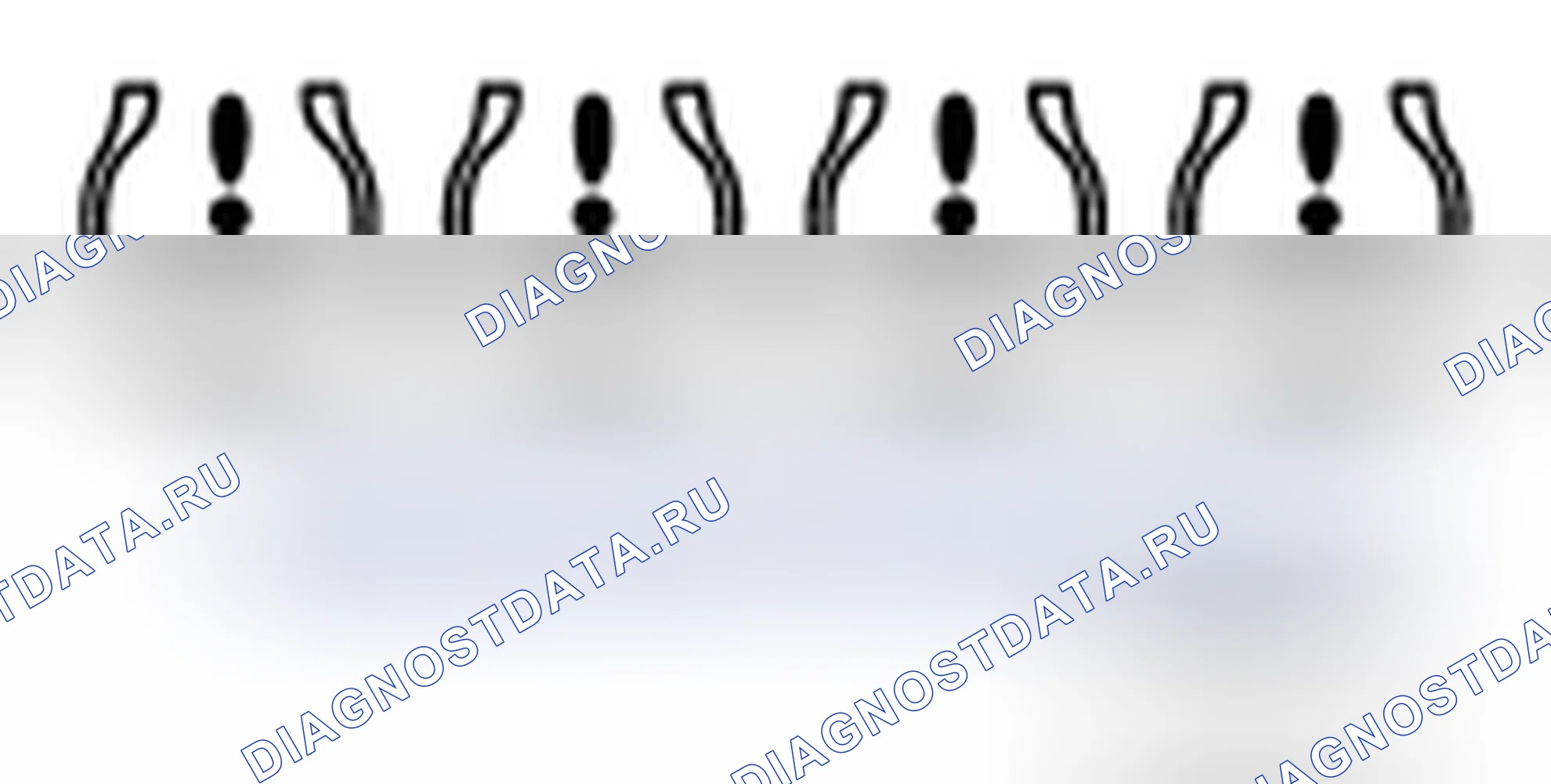 Рис. 14. BMW 4 серия F32/F33 рестайлинг