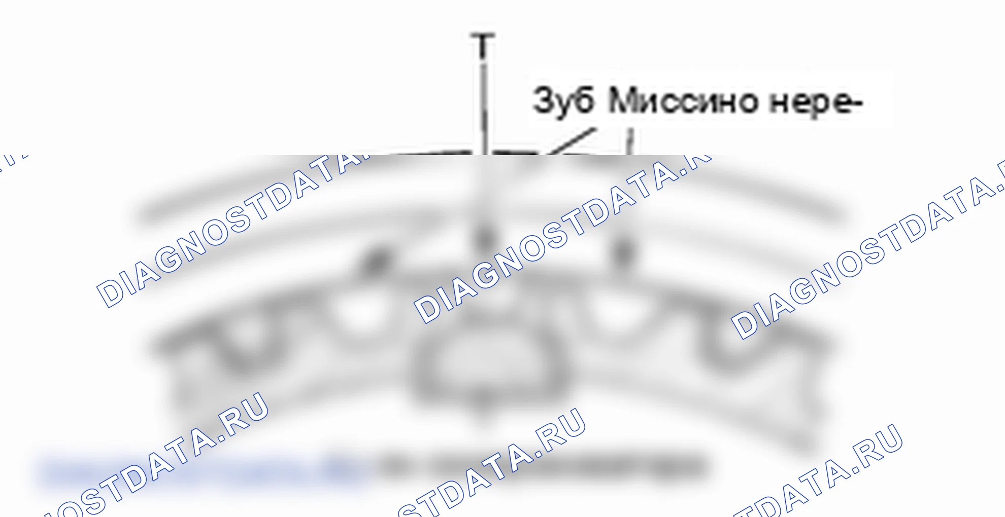 Сборка главного вала. Hyundai H-1 A1