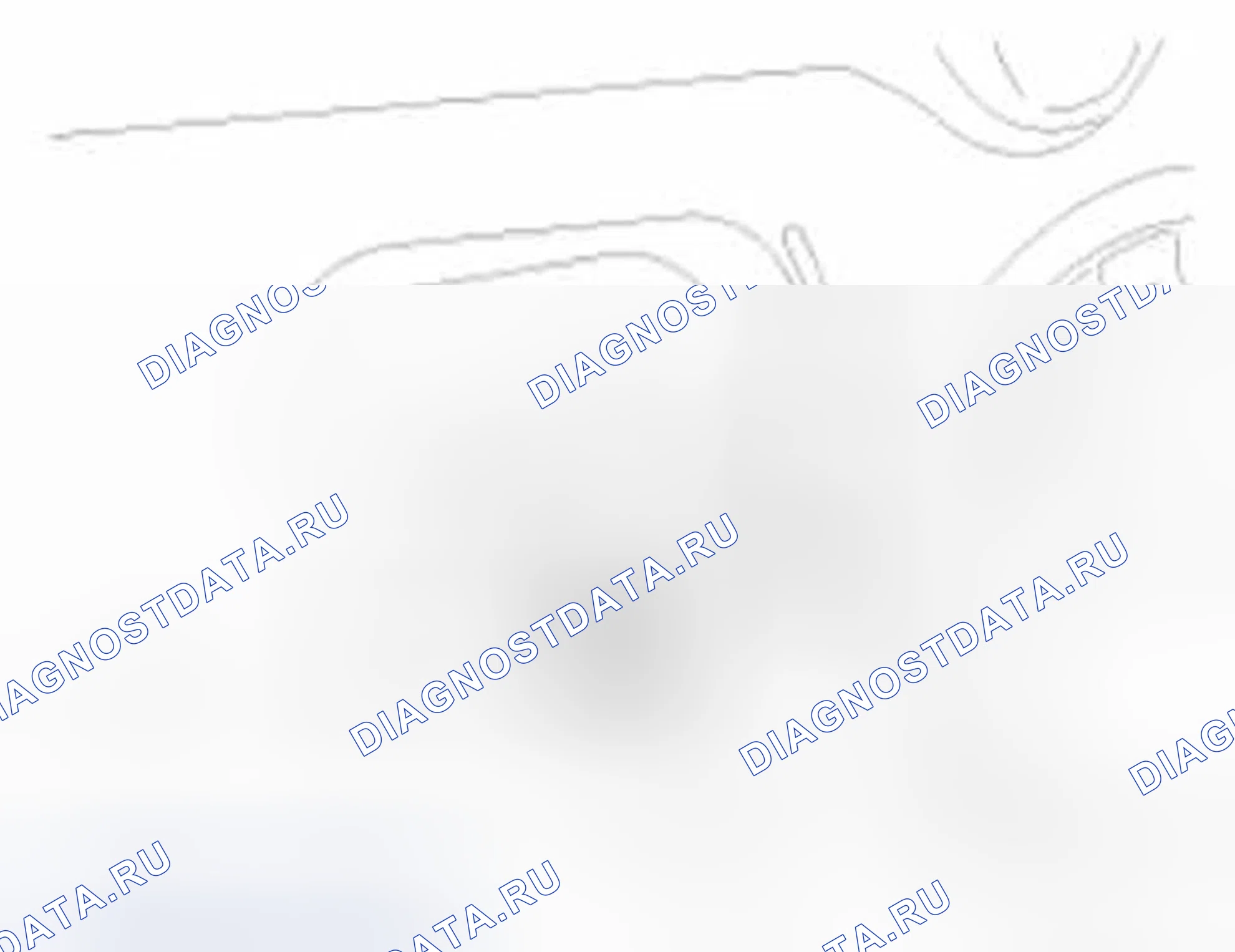 Рис. 43: Датчик бокового удара под давлением. Hyundai Veloster I