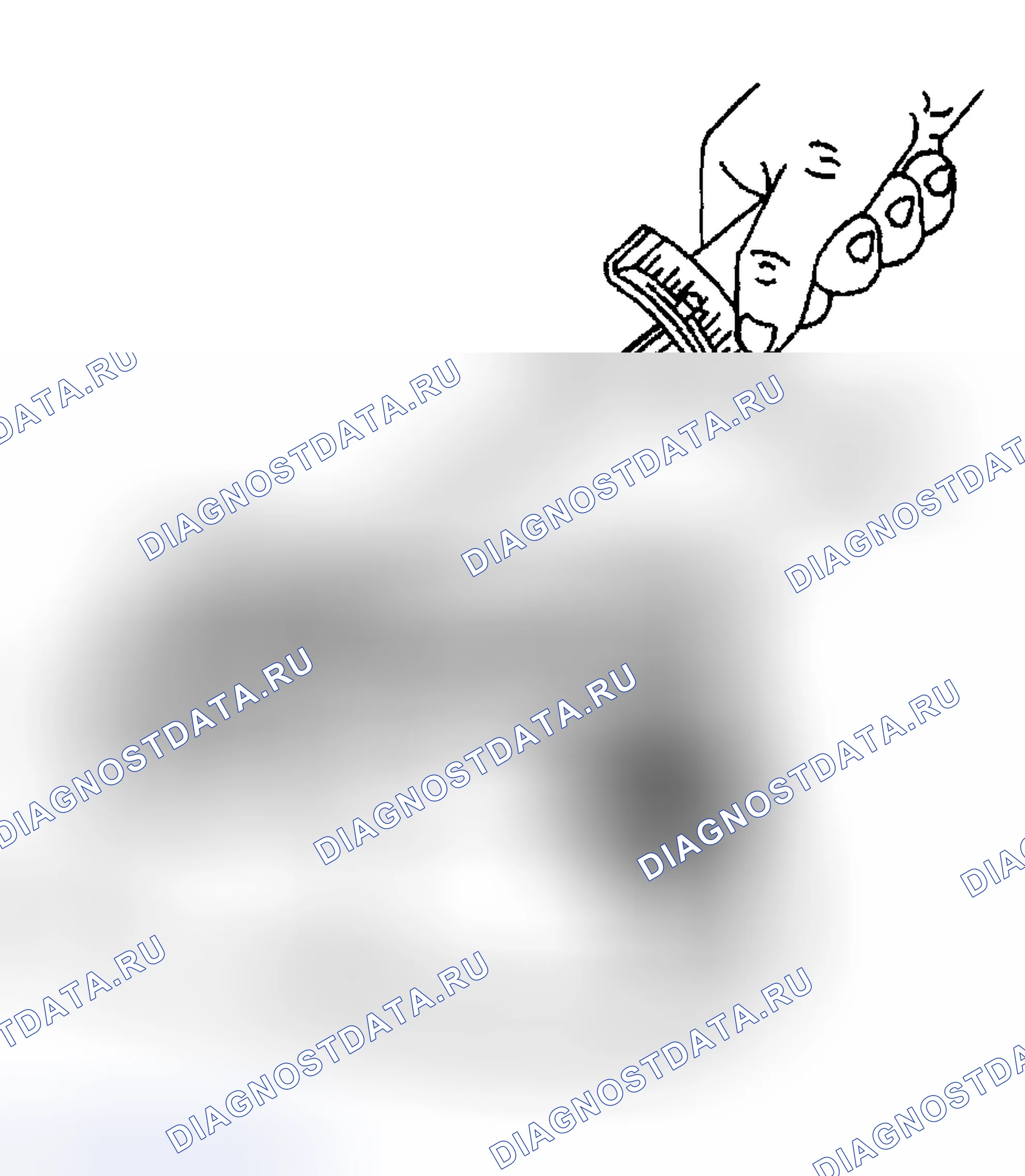 Рис. 1552: Процедура измерения. Hyundai Terracan I