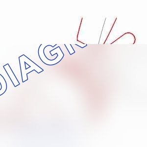 Использование: хомуты LIGAREX — b2fk023c. Peugeot 106 I рестайлинг
