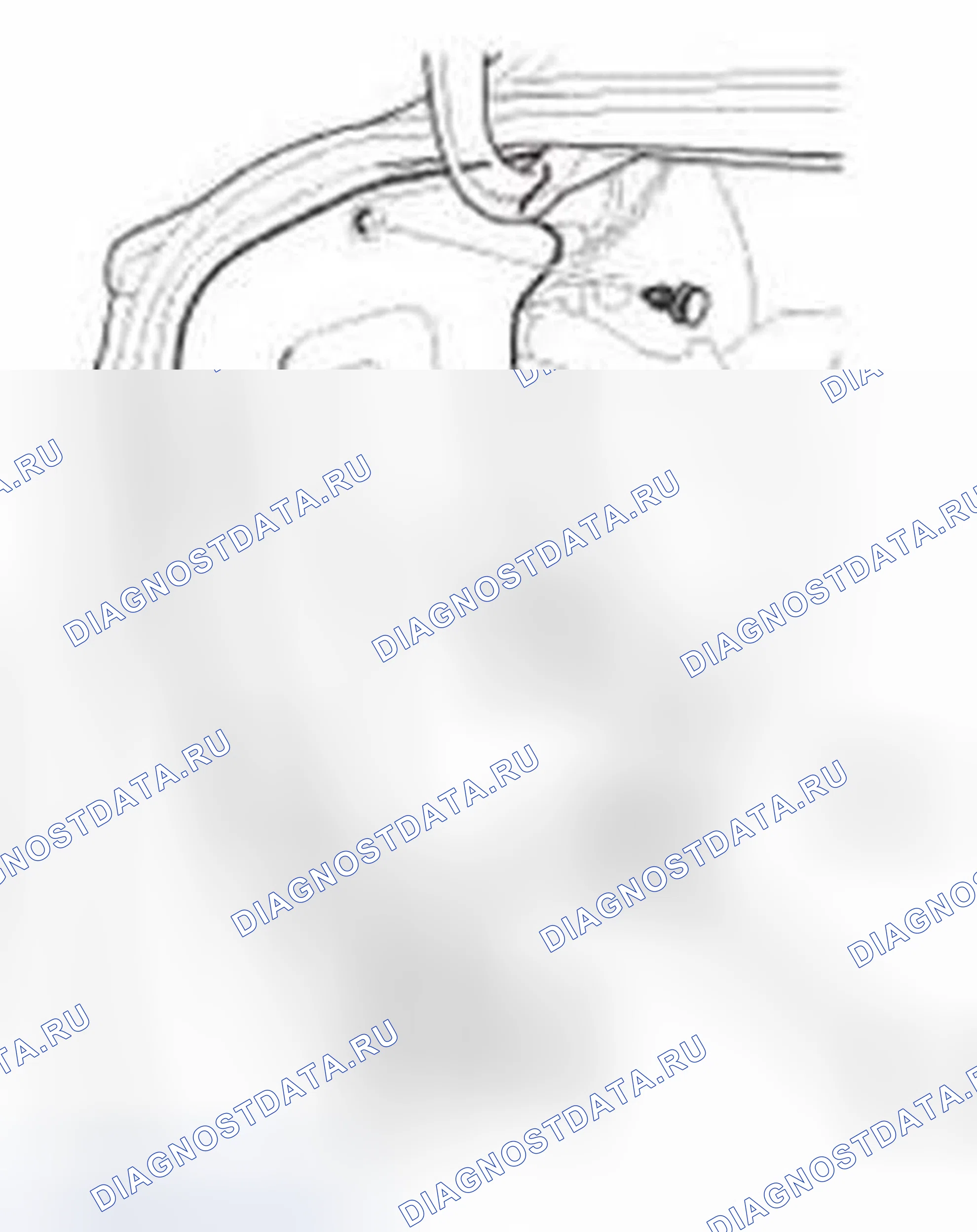 Рис. 1064: Установка. Honda Civic IX