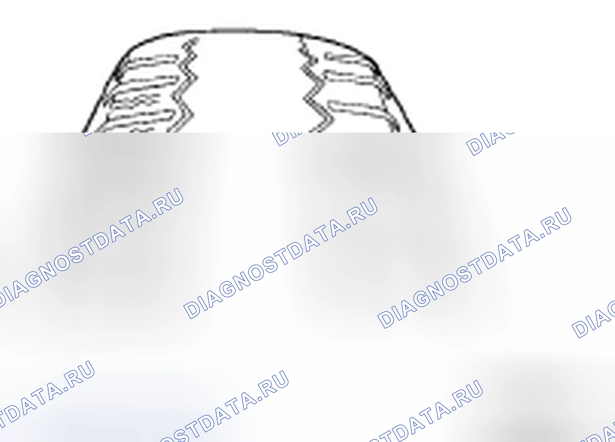 Рис. 1. Hyundai Azera I