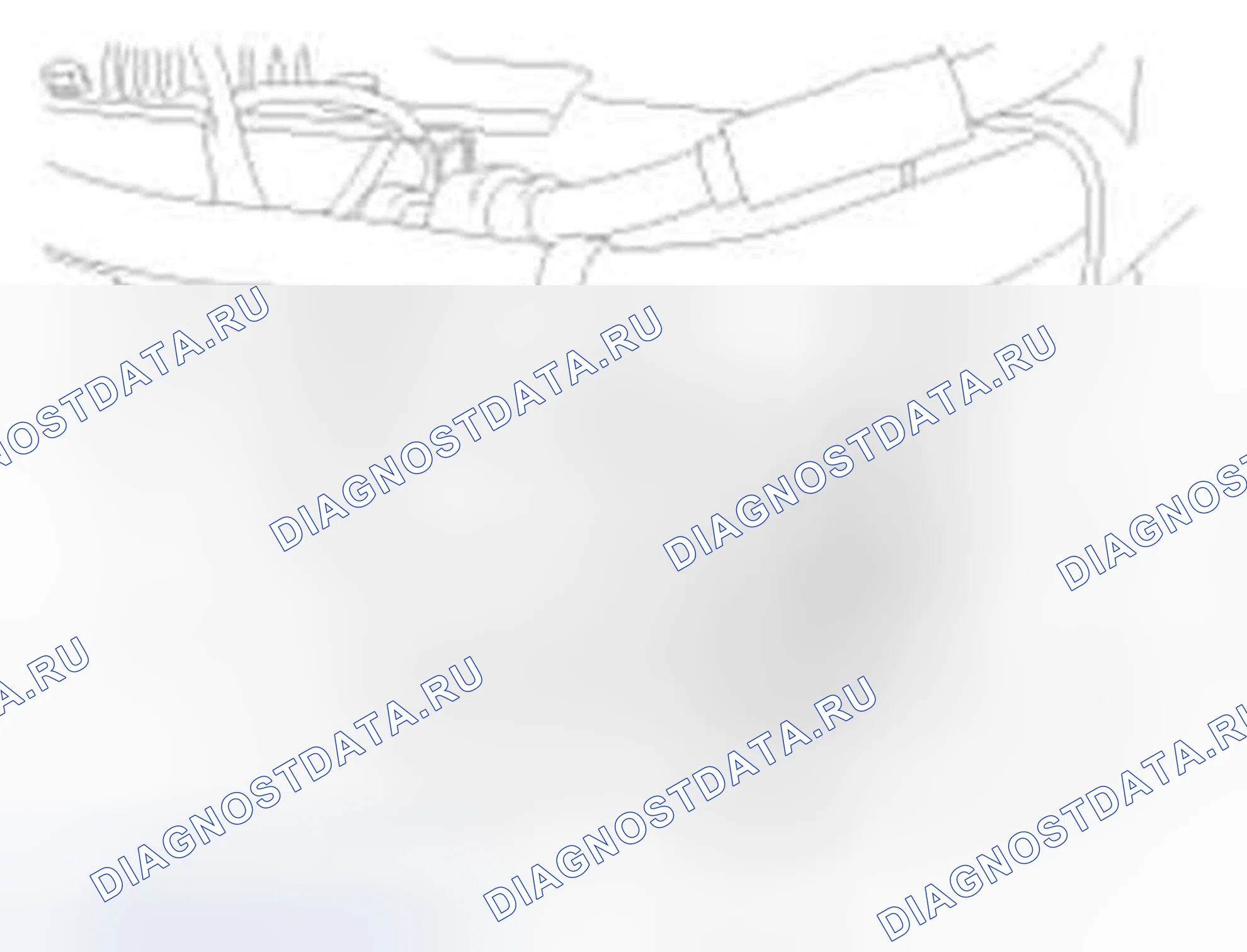 Рис. 74: Удаление. Hyundai Elantra V