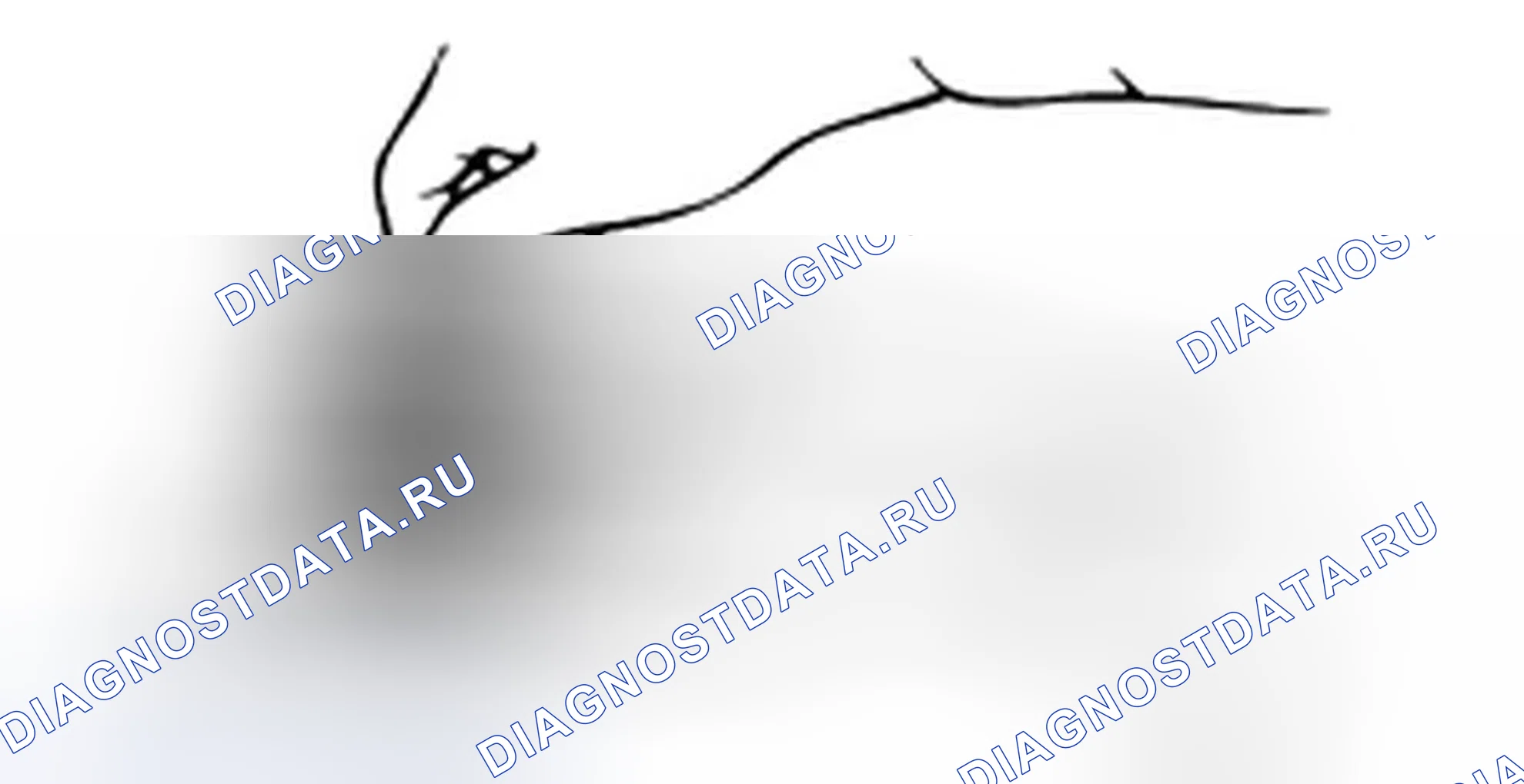 Сборка передней несущей панели дифференциала (4WD). Hyundai H-1 A1