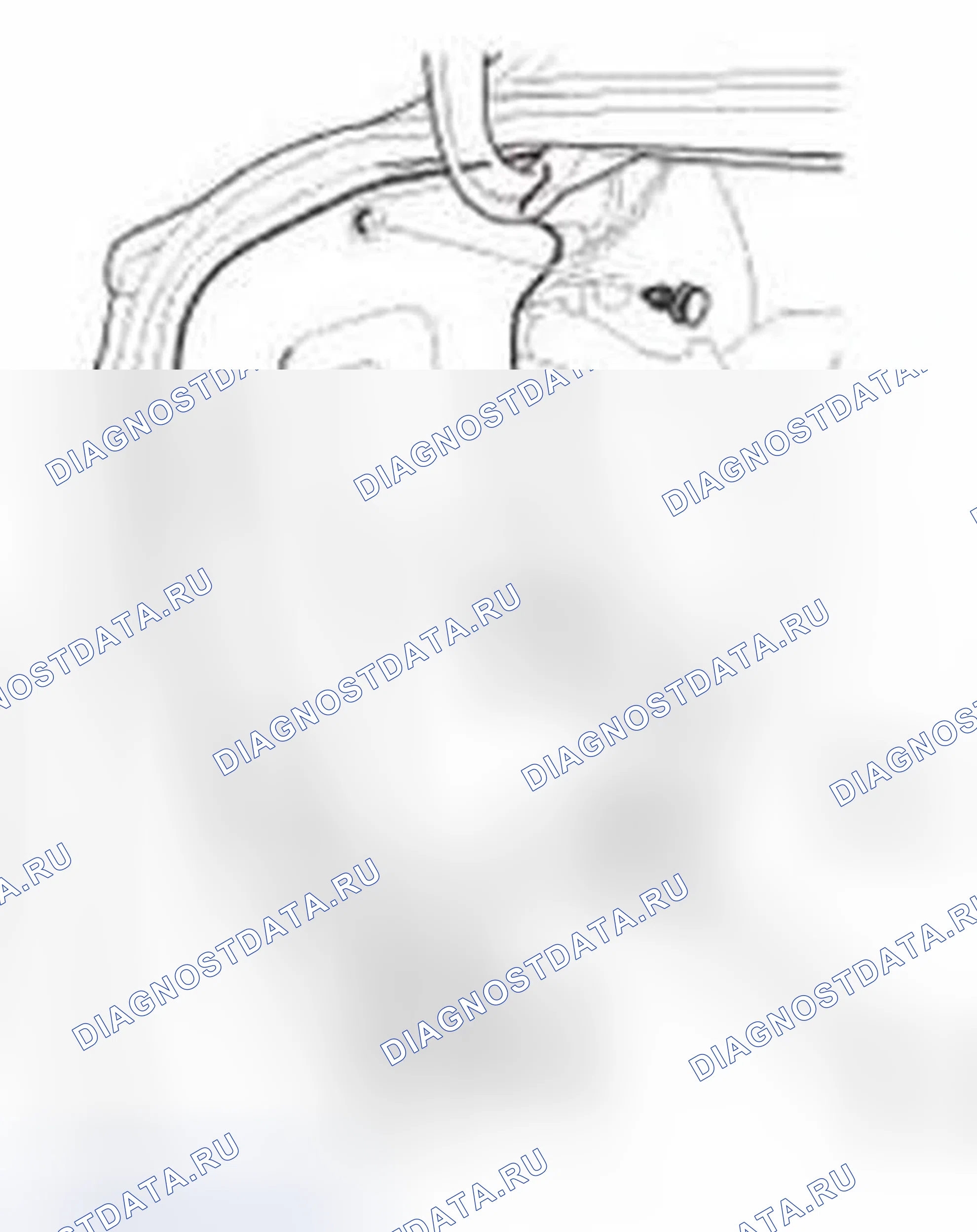 Рис. 1063. Honda Civic IX