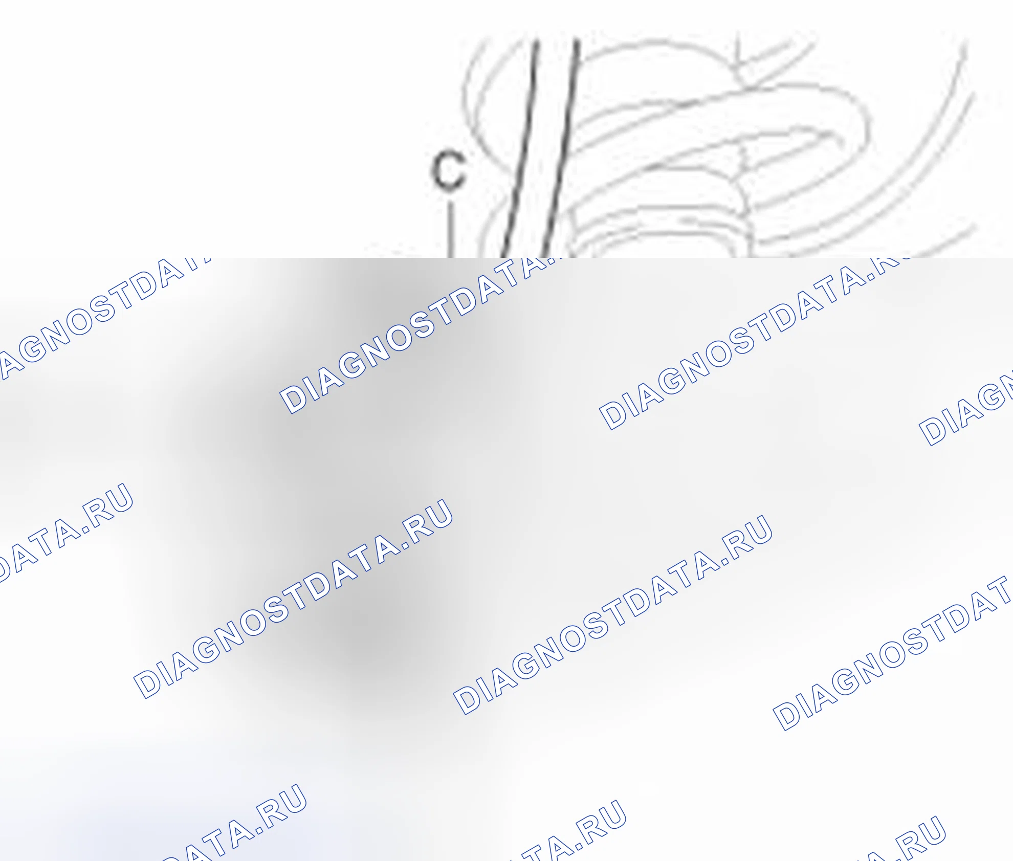 Рис. 42: Демонтаж. Geely SC7 I