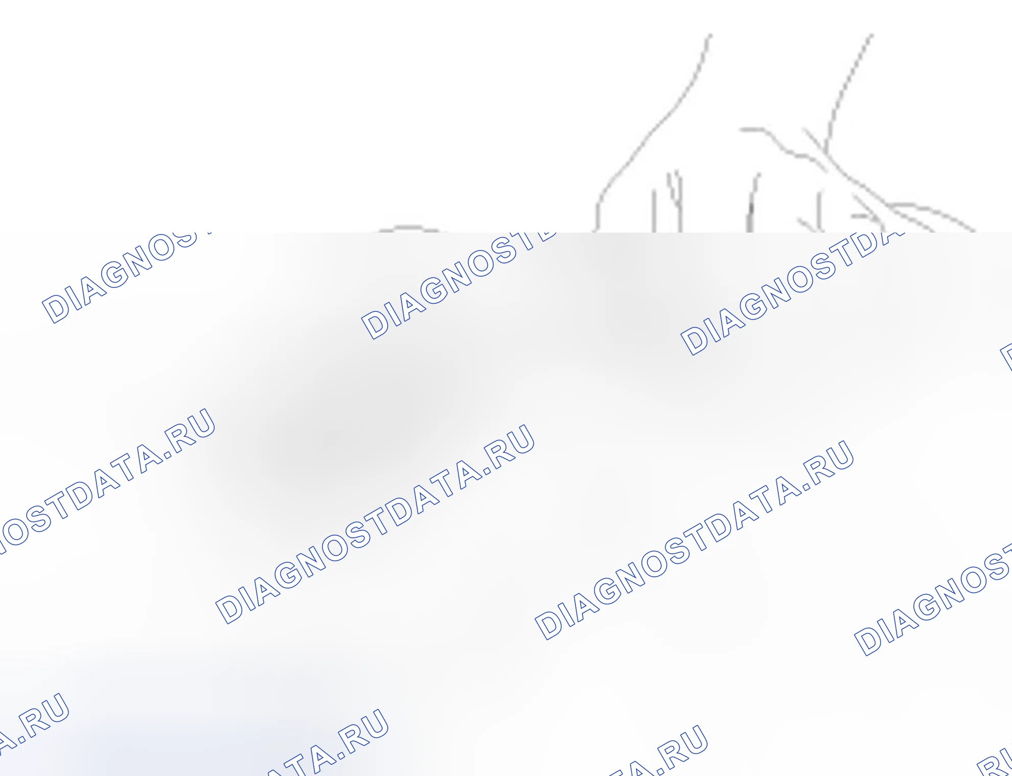 Рис. 103. Hyundai Accent III