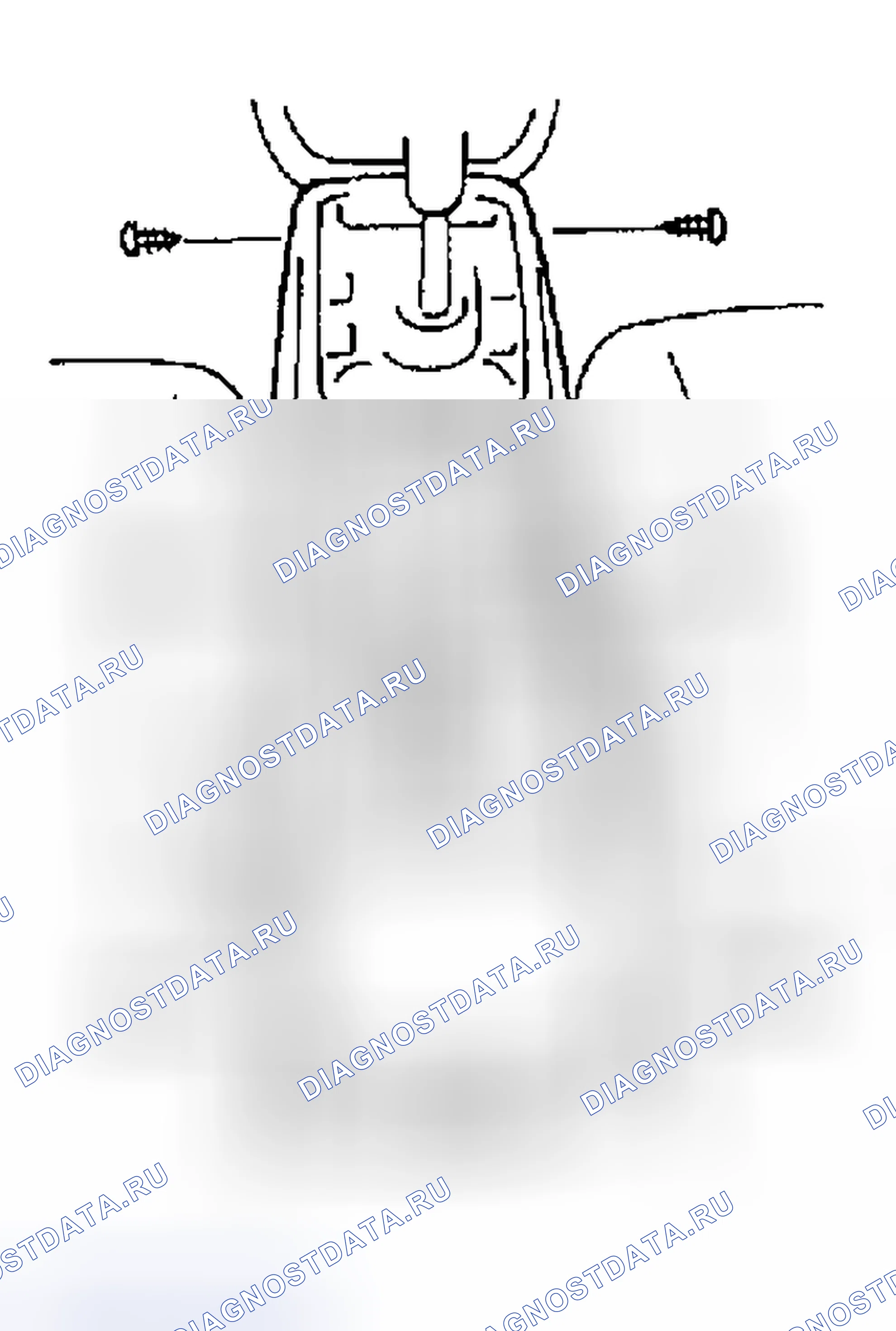 Рис. 113: Демонтаж. Suzuki Vitara I