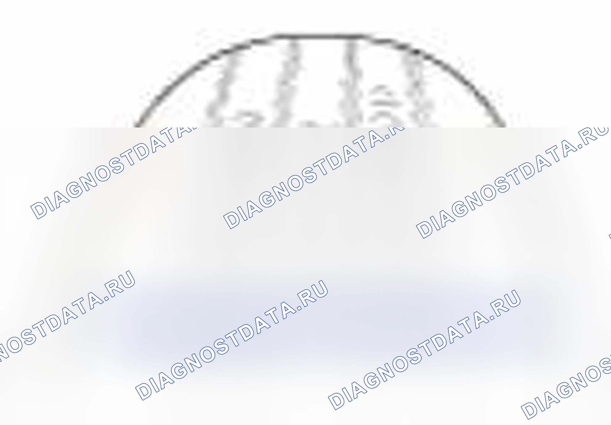 Рис. 8. Kia Forte I
