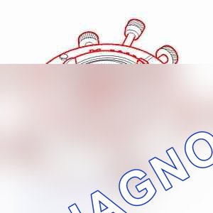 Разборка - сборка: синхронизатор — b2ck11fc. Peugeot 607 I