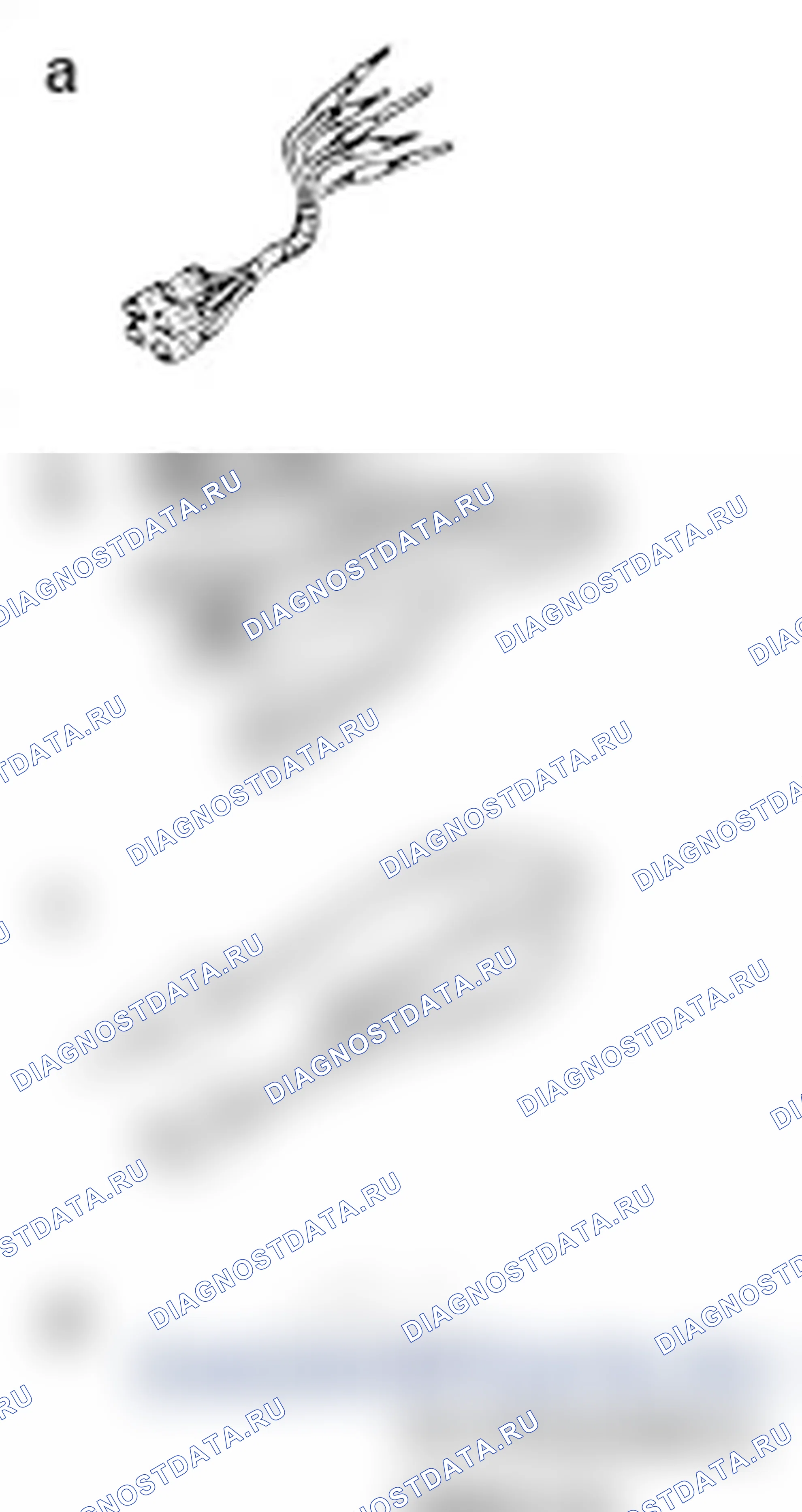 Рис. 11. Mitsubishi Lancer Ralliart X рестайлинг