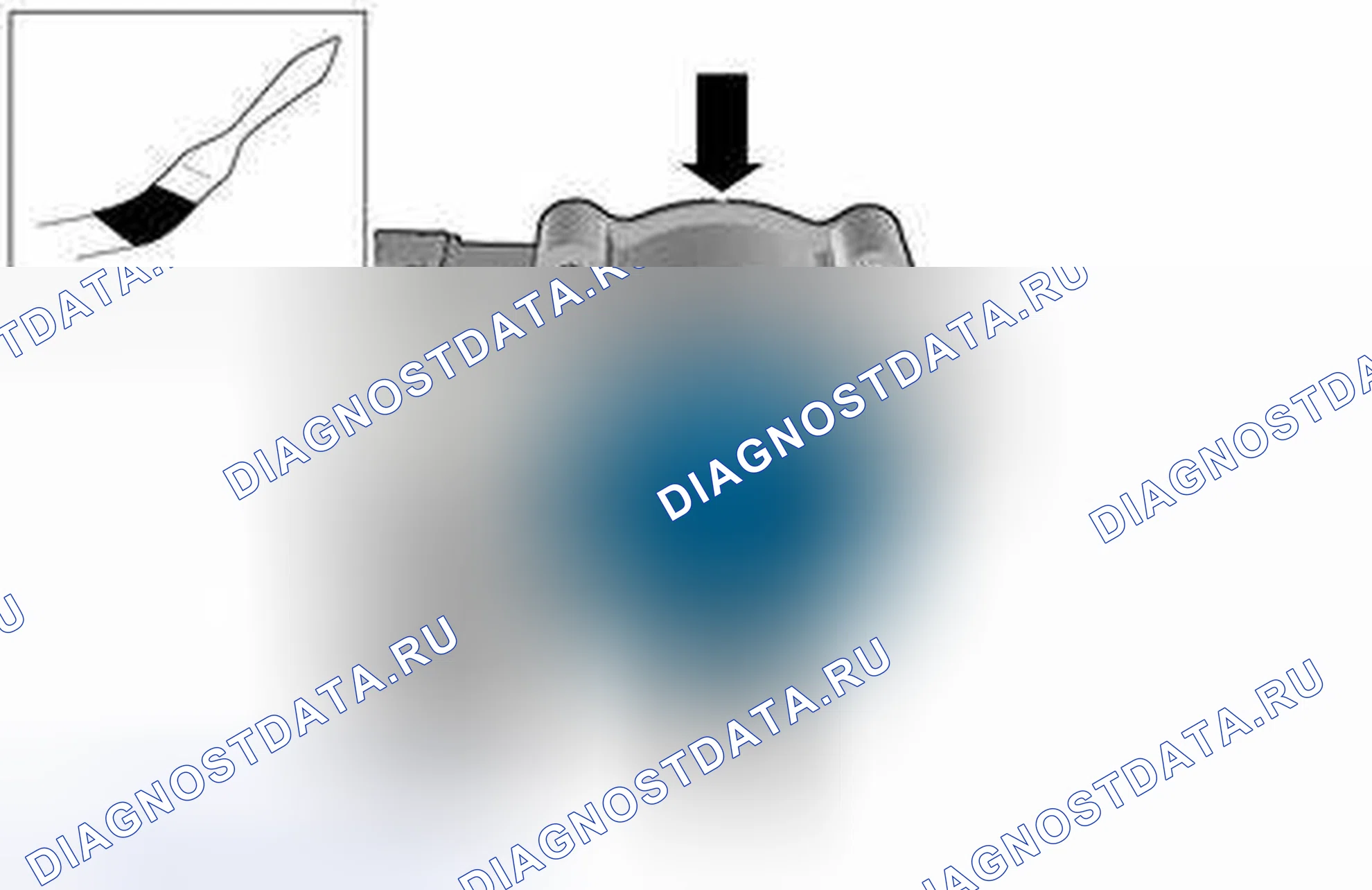 Рис. 79: ОЧИСТКА. Volvo V50 I