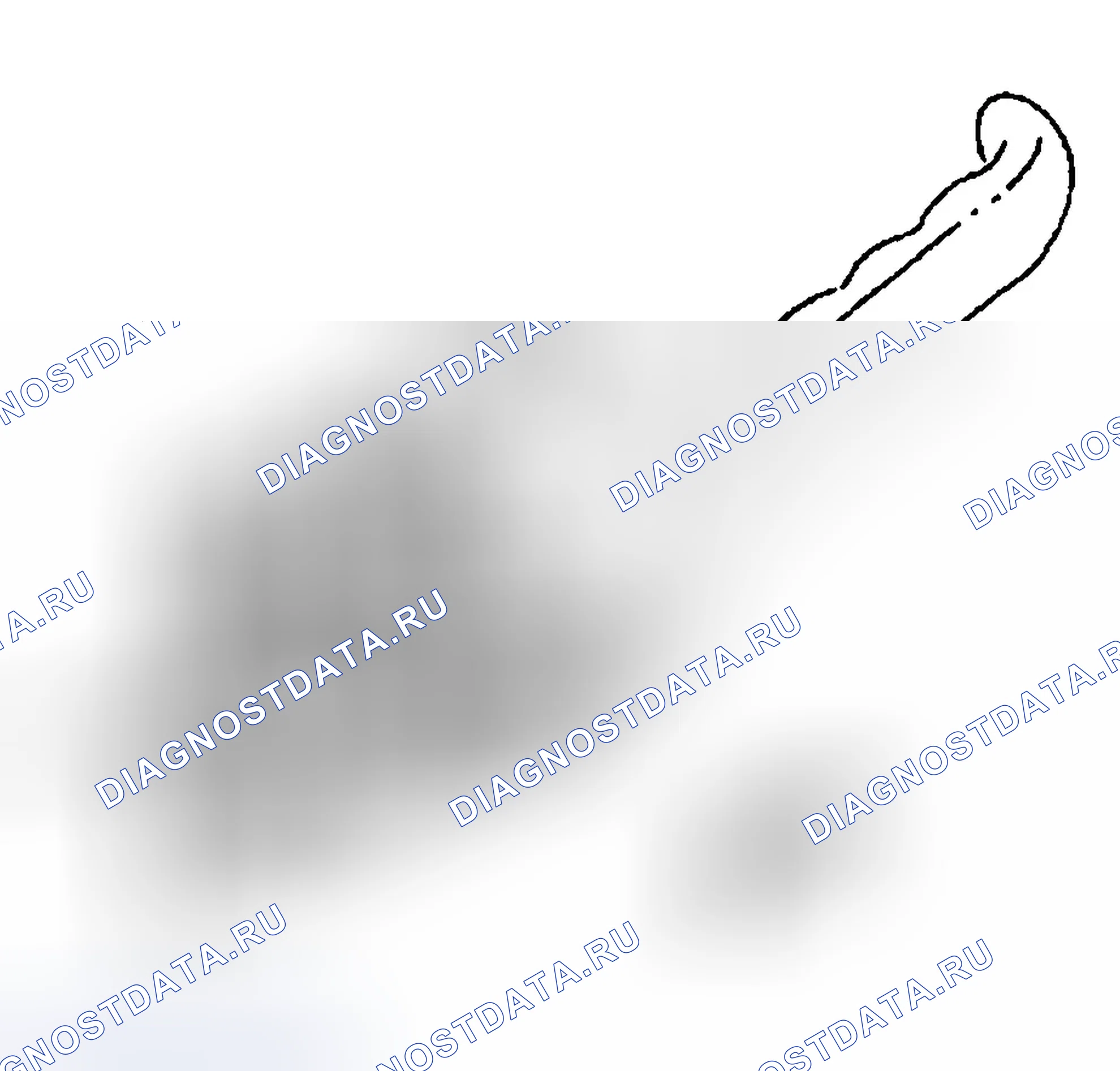 Рис. 247: Порядок демонтажа. Chevrolet Silverado 1500 HD 