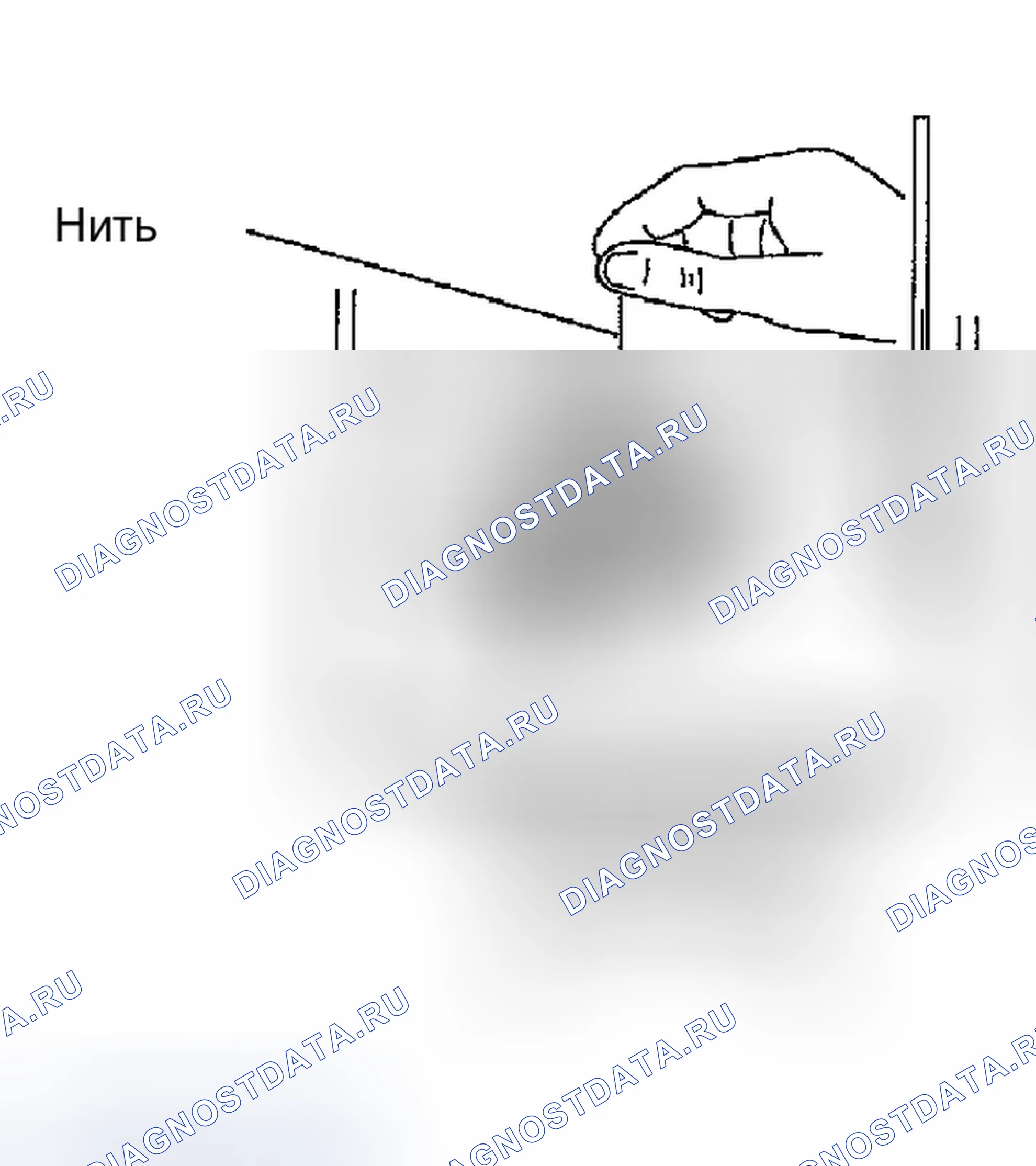 Рис. 8: Осмотр после удаления. Infiniti FX45 I