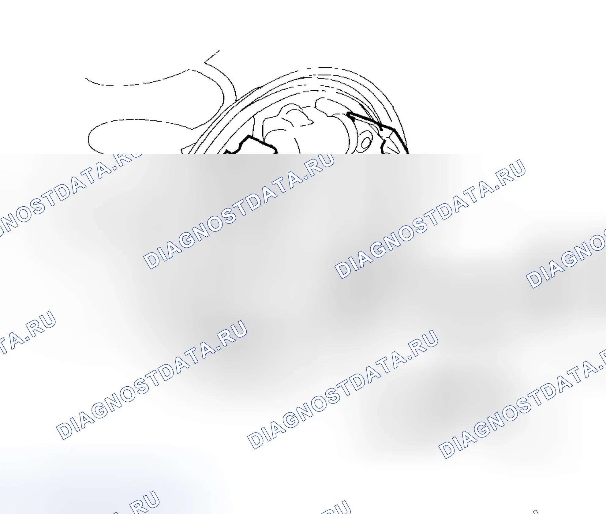 Рис. 30: Демонтаж / разборка. Honda Insight I
