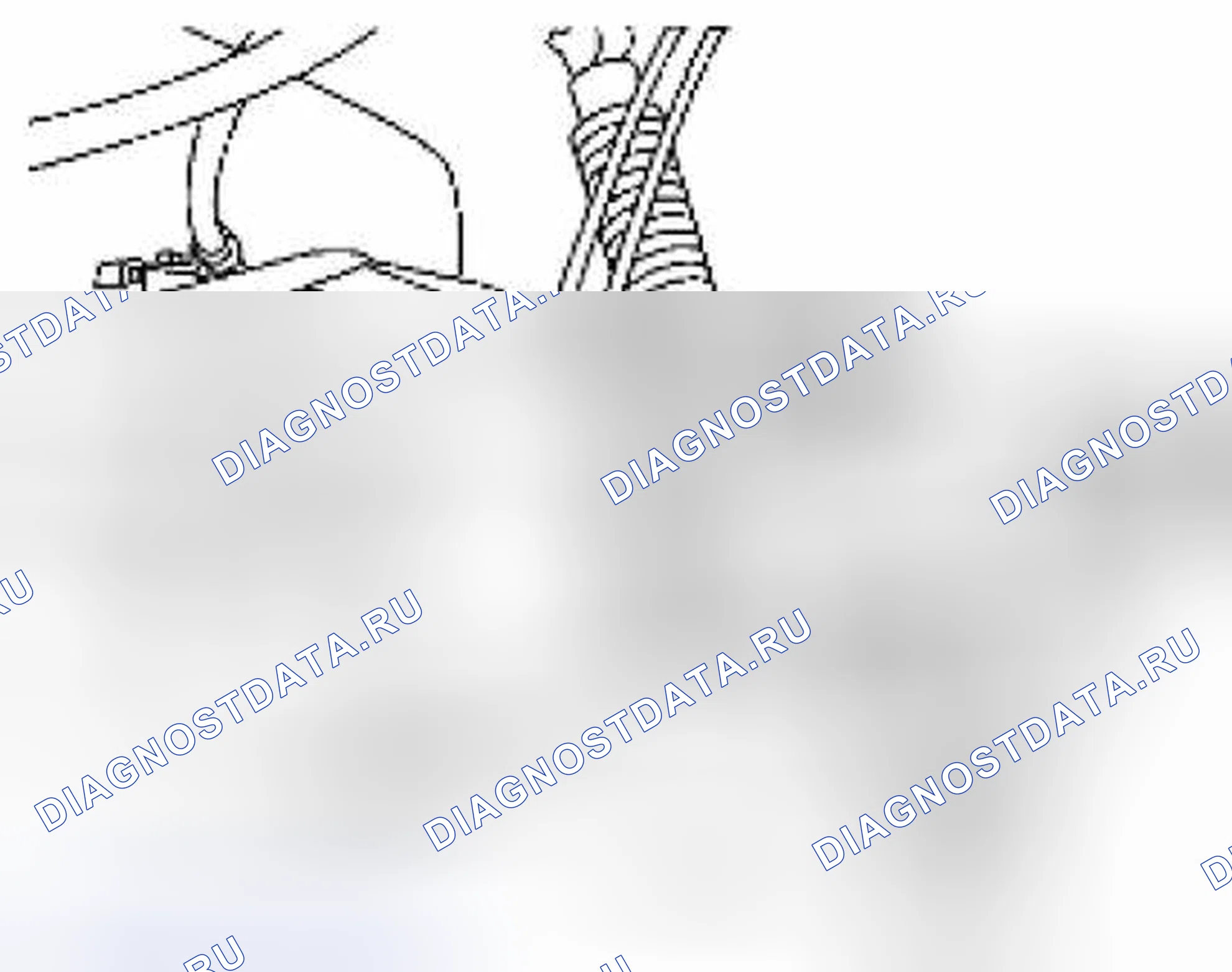 Рис. 149: УДАЛЕНИЕ. Suzuki Equator I