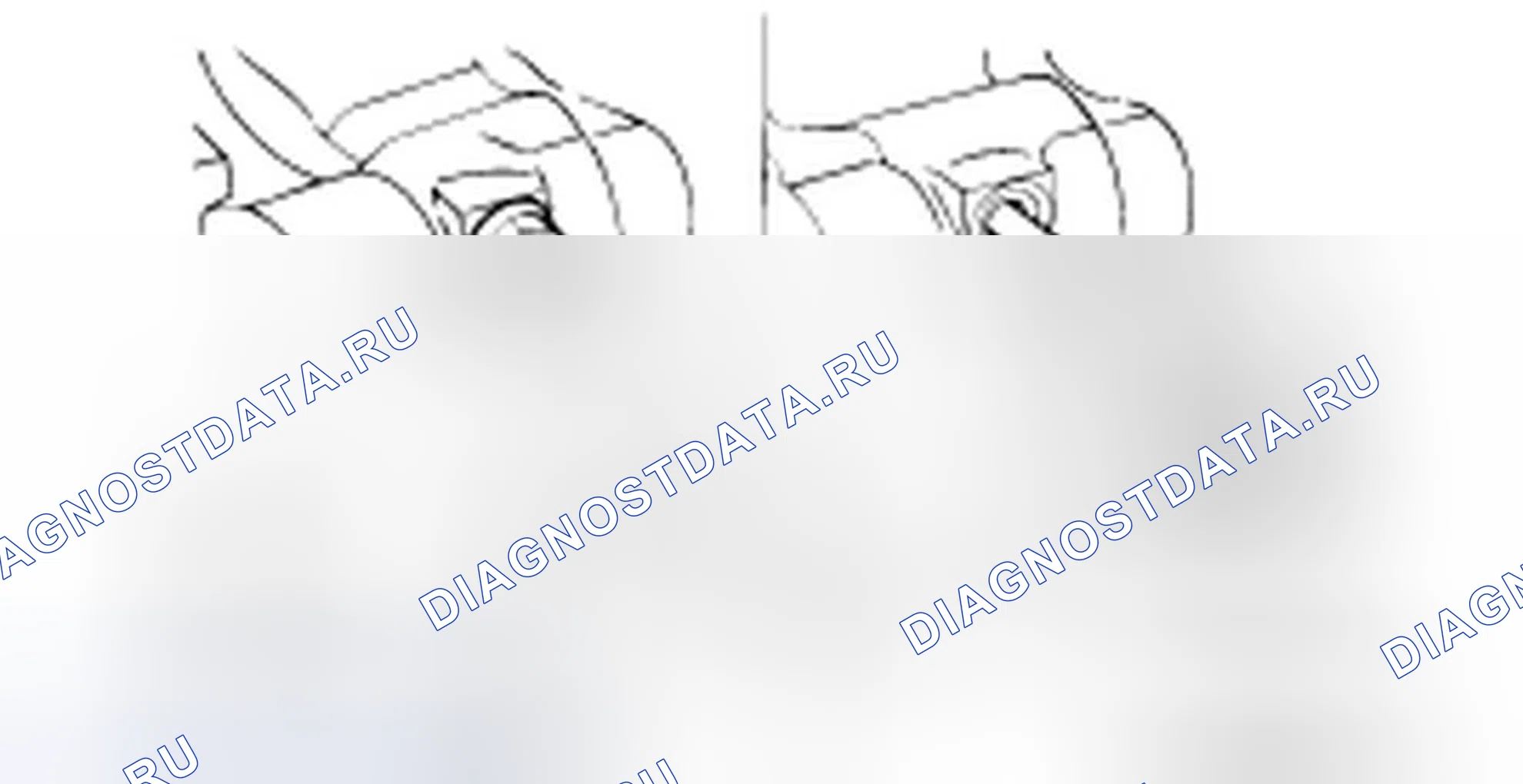Разборка переднего корпуса. Hyundai H-1 A1