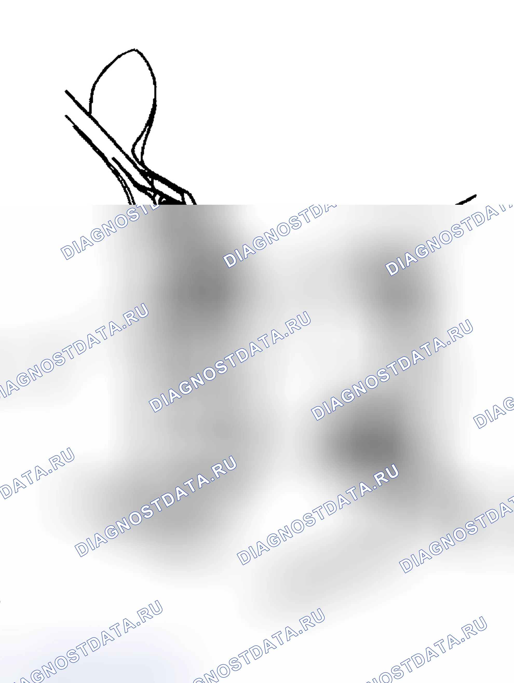 Рис. 148: Процедура установки. Hyundai Venue I