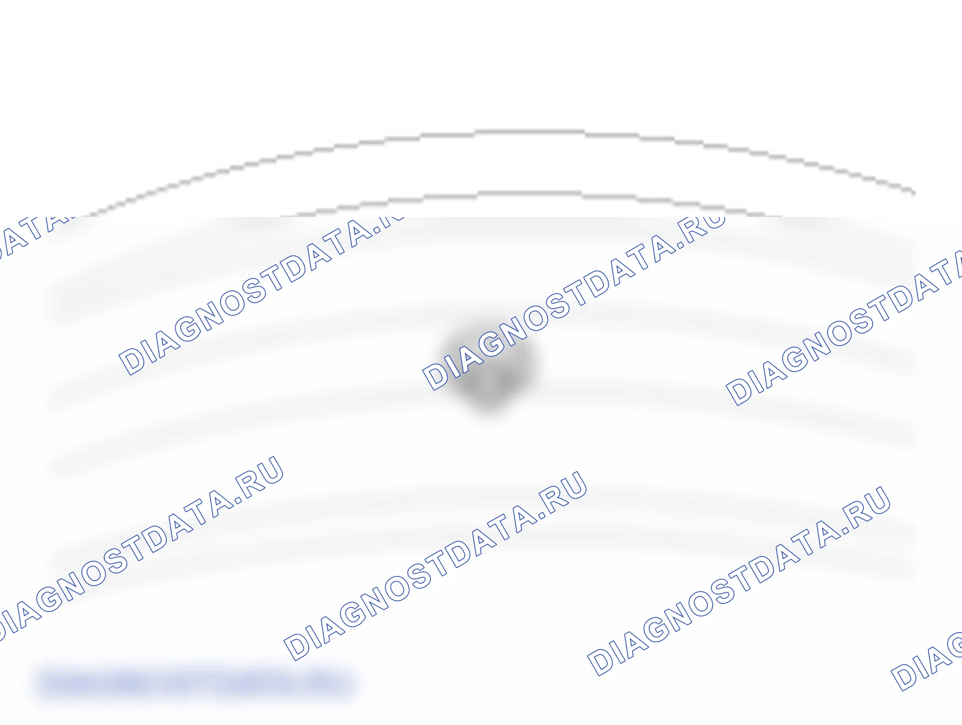 Замена датчика TPMS. Hyundai i20 GB