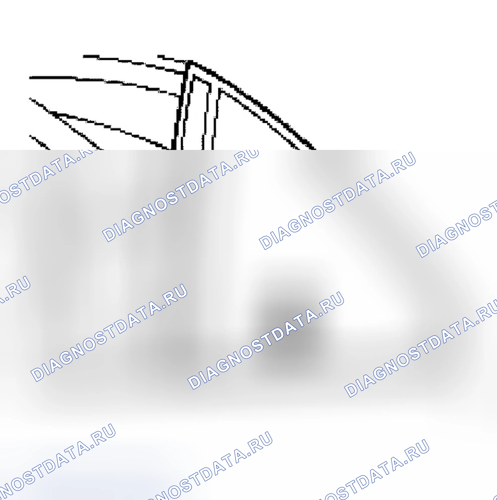 Рис. 21: Установка. Jaguar XJR III