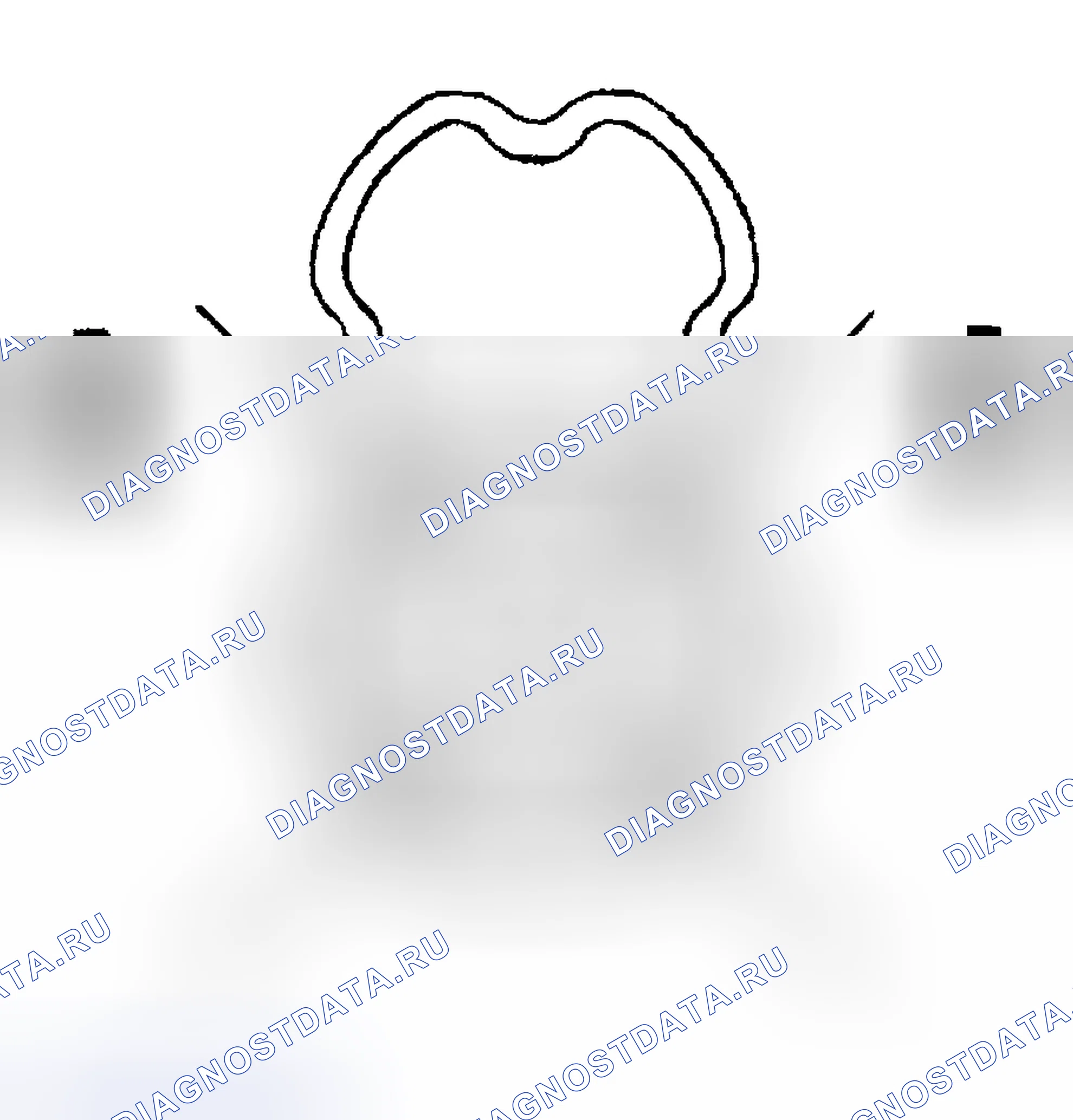 Рис. 100. Buick Regal IV